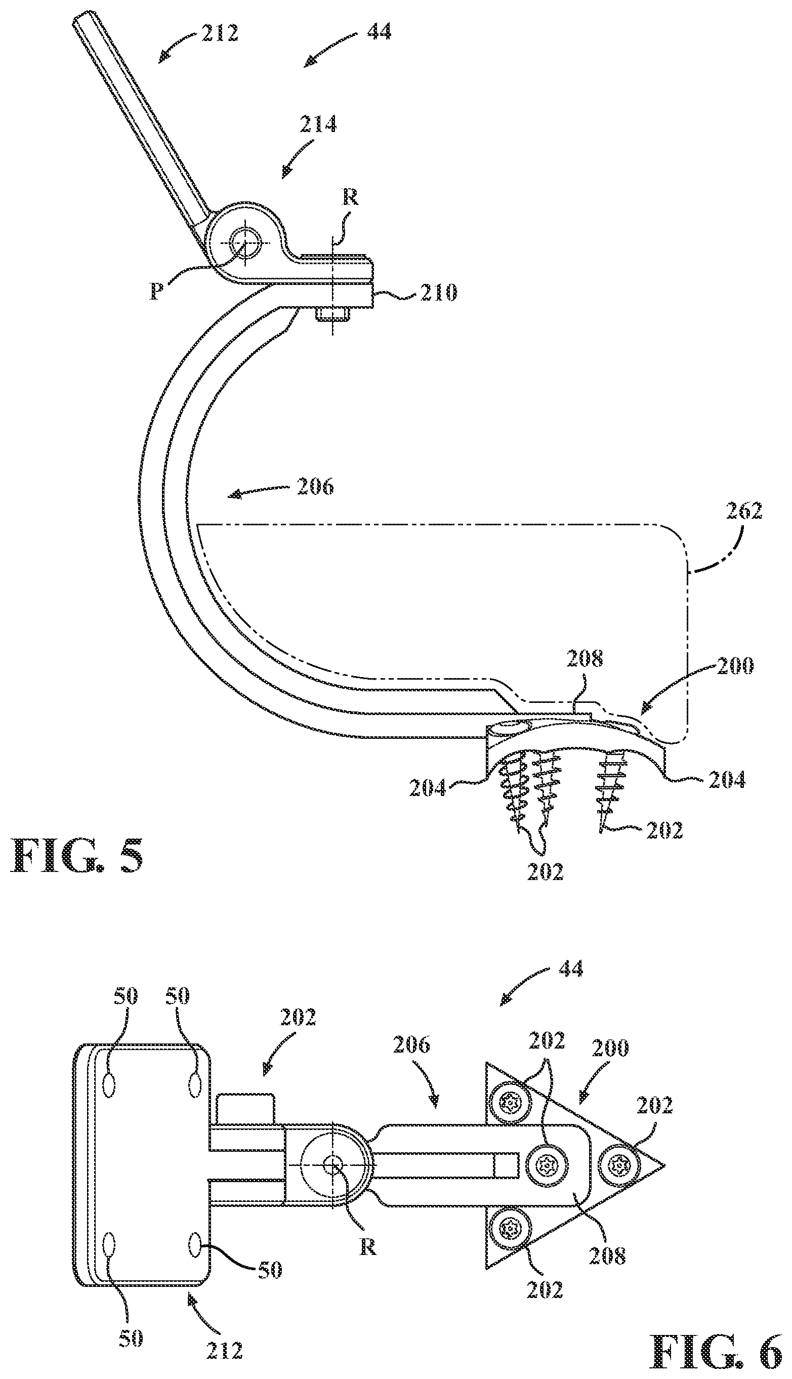 Patent US12102365 Figure 5 – Bone plate for attaching to an anatomic structure