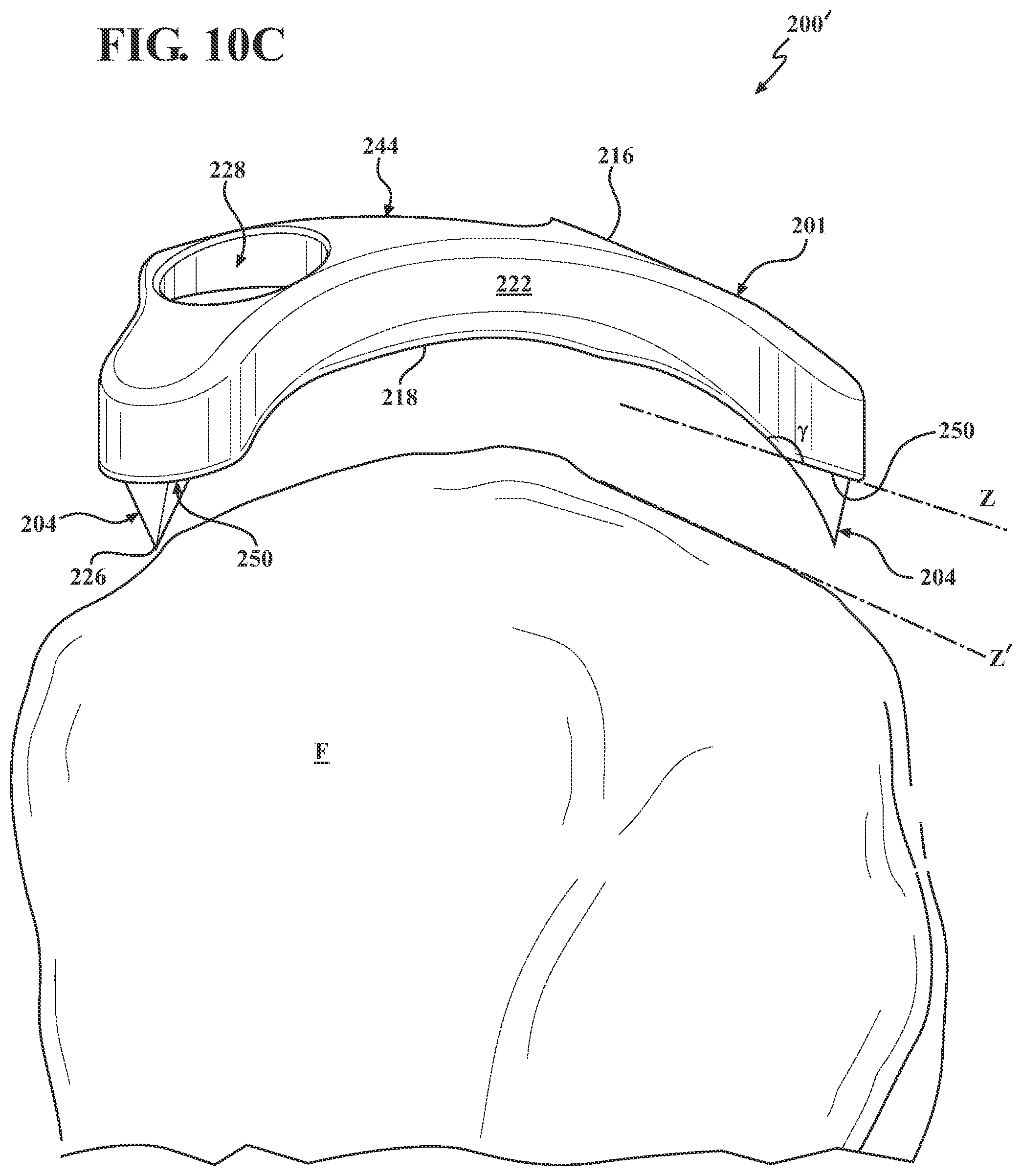 Patent US12102365 Figure 9 – Bone plate for attaching to an anatomic structure