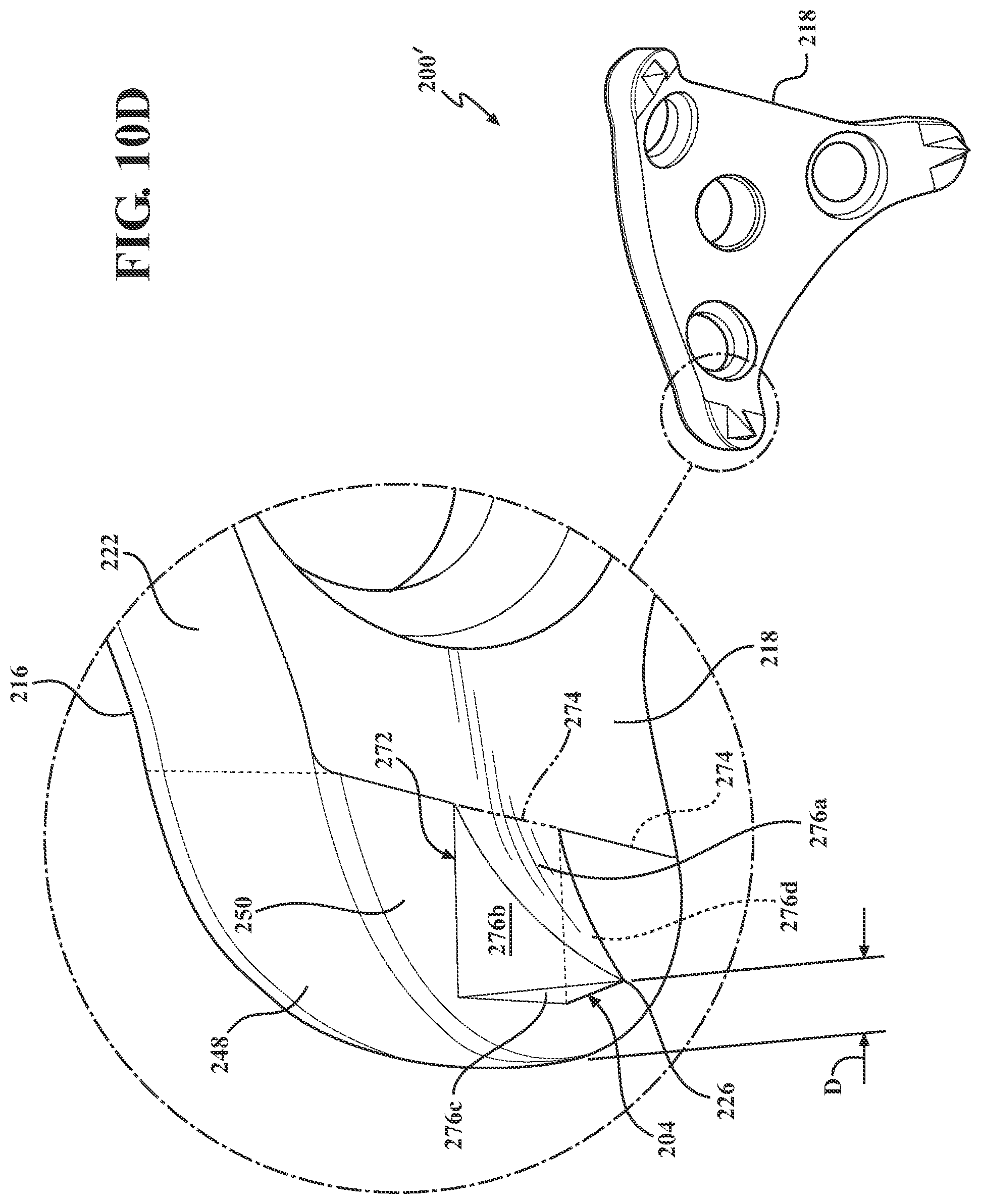 Patent US12102365 Figure 10 – Bone plate for attaching to an anatomic structure