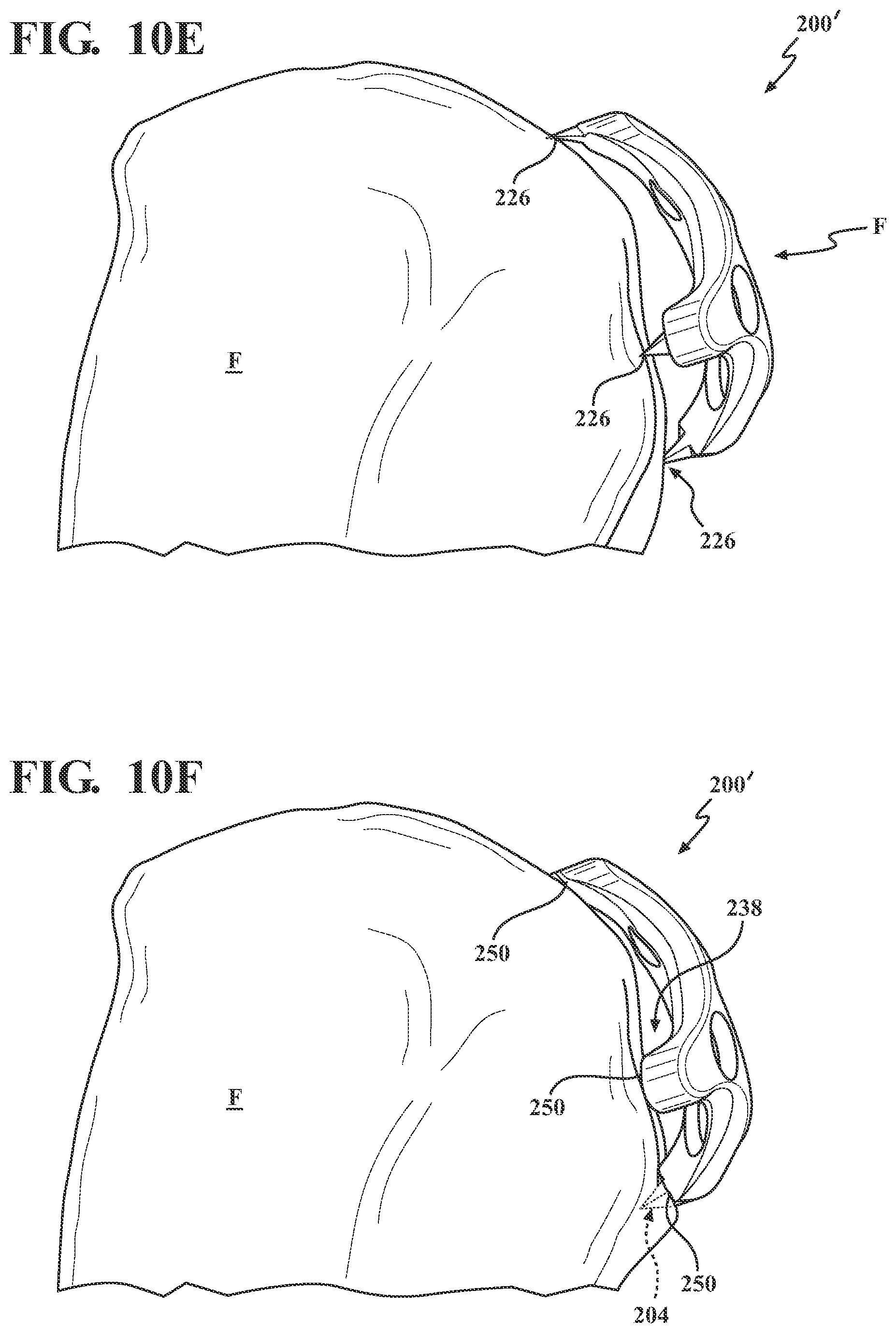 Patent US12102365 Figure 11 – Bone plate for attaching to an anatomic structure
