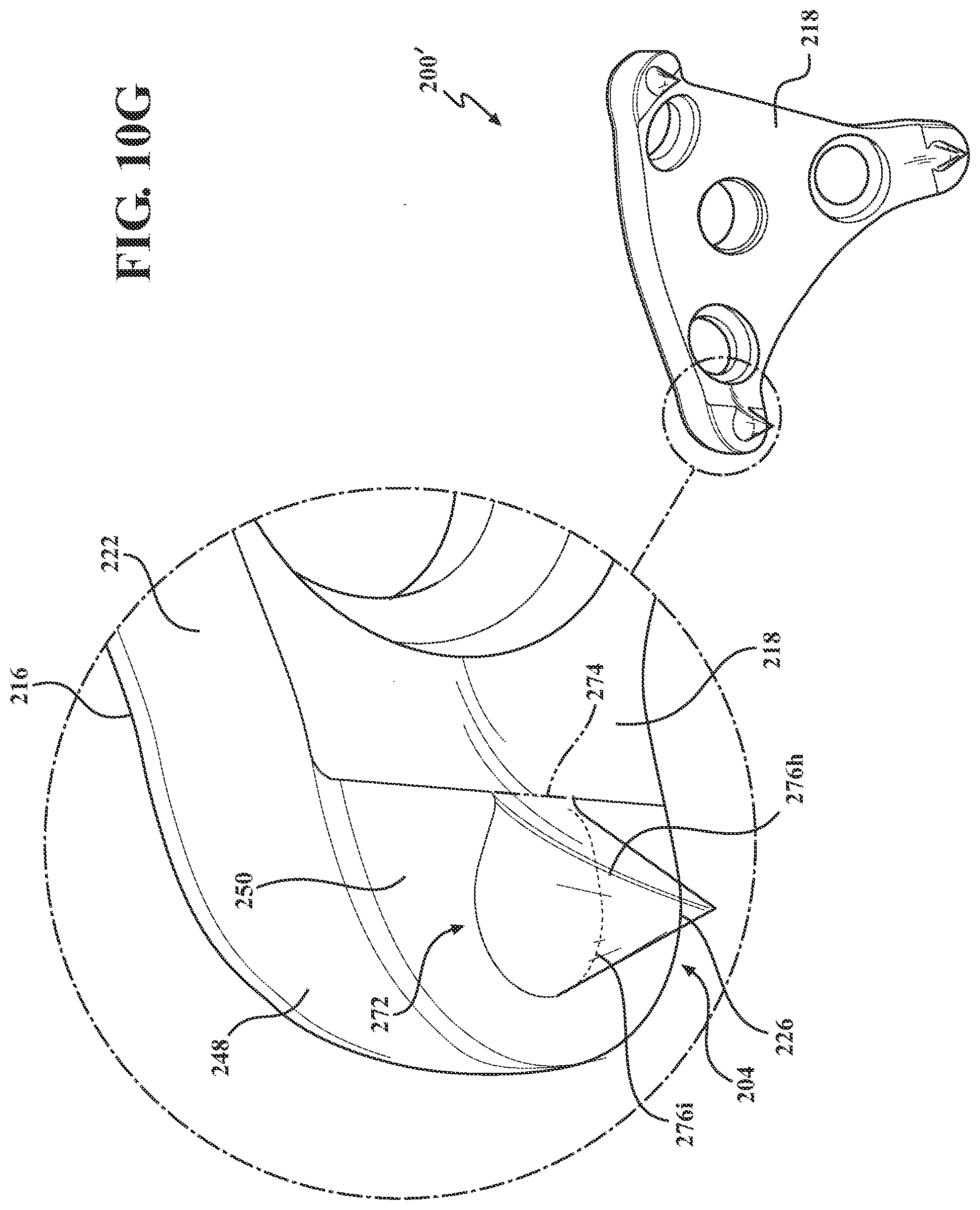 Patent US12102365 Figure 12 – Bone plate for attaching to an anatomic structure