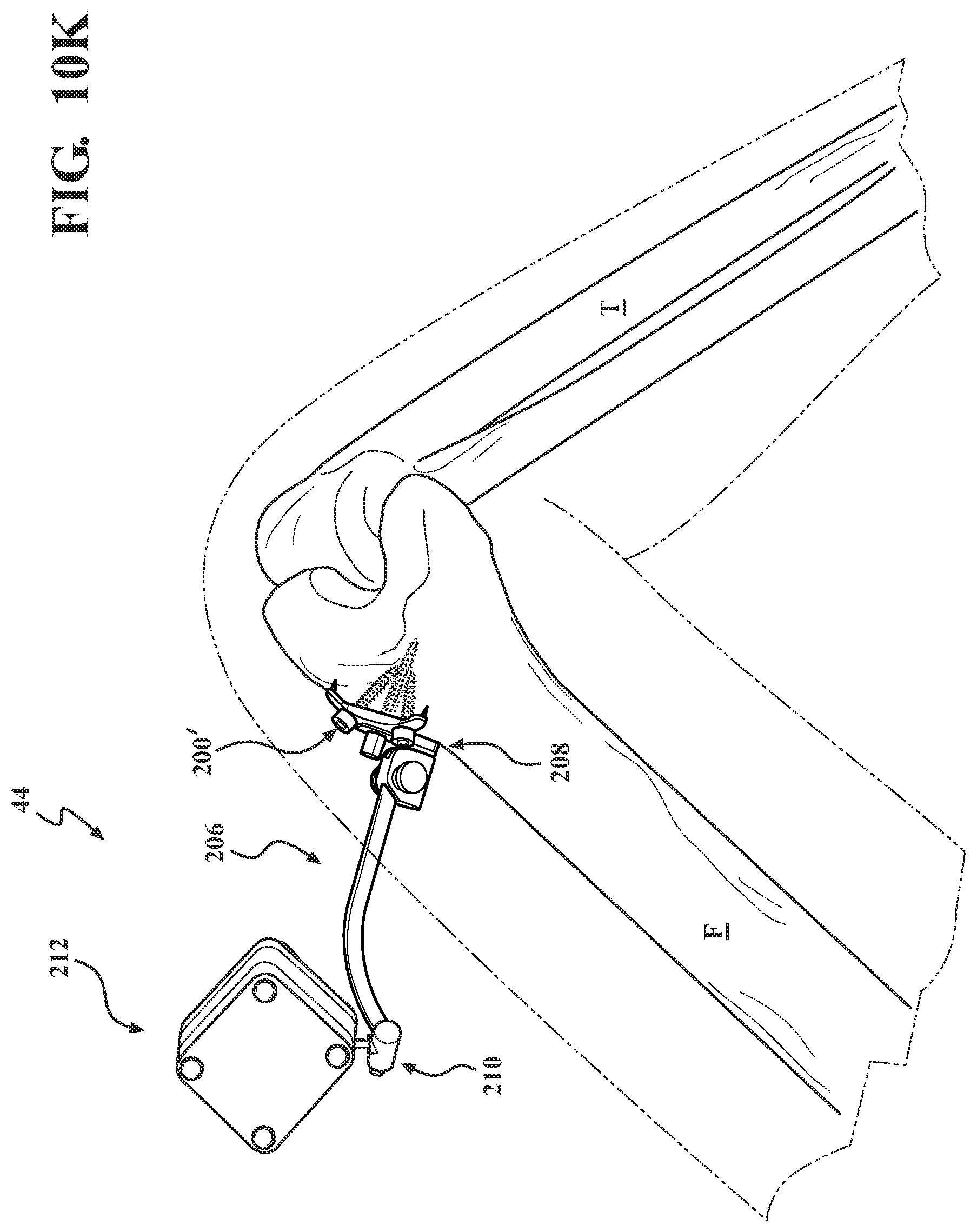 Patent US12102365 Figure 16 – Bone plate for attaching to an anatomic structure