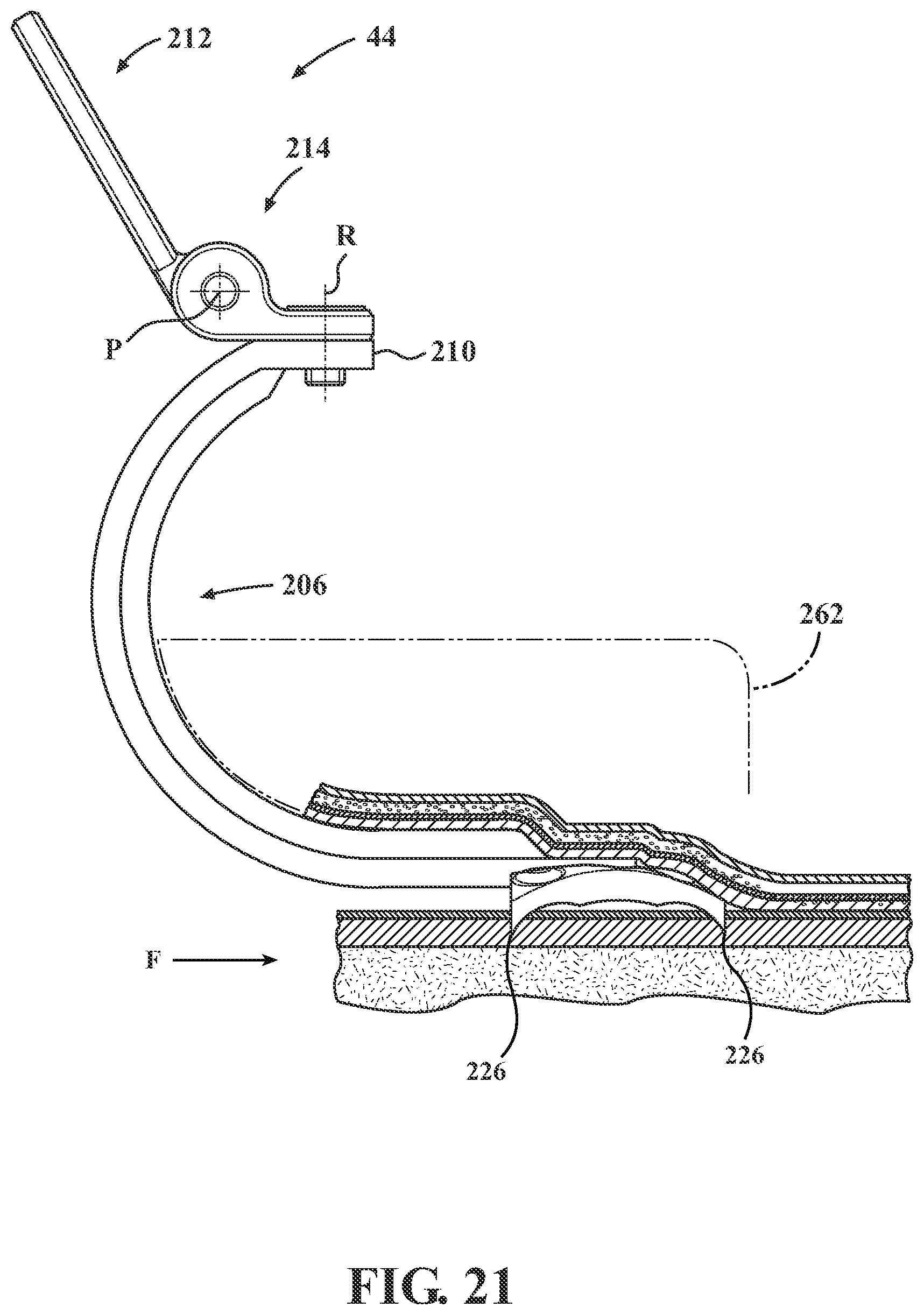 Patent US12102365 Figure 20 – Bone plate for attaching to an anatomic structure