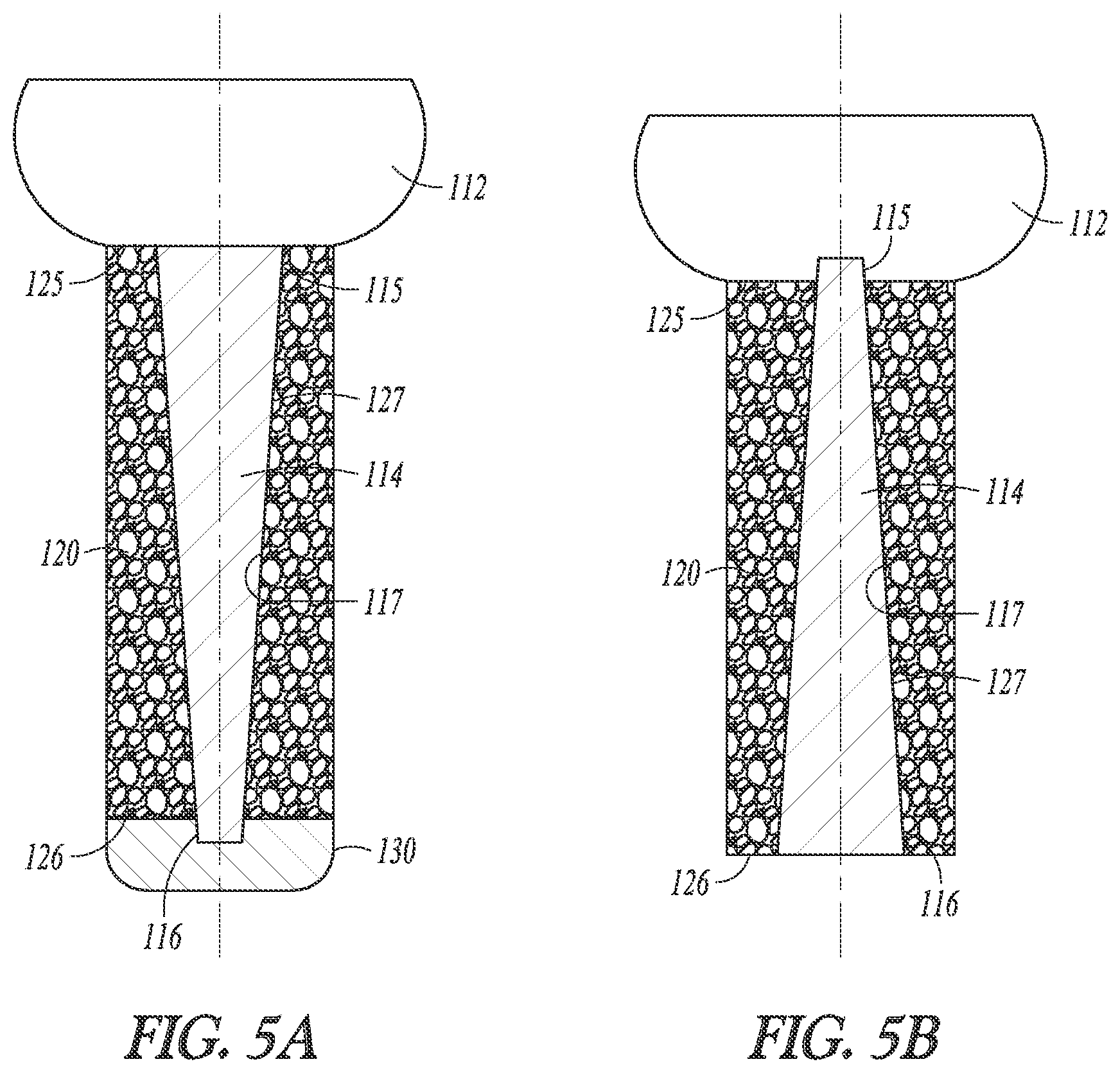 Patent US12102366 Figure 5 – Poly-axial fixation posts