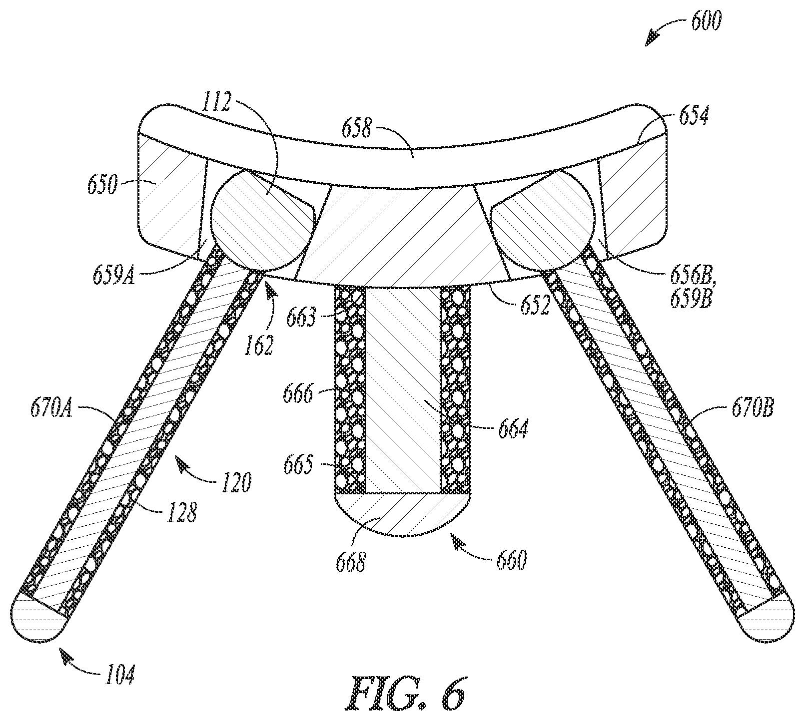 Patent US12102366 Figure 6 – Poly-axial fixation posts