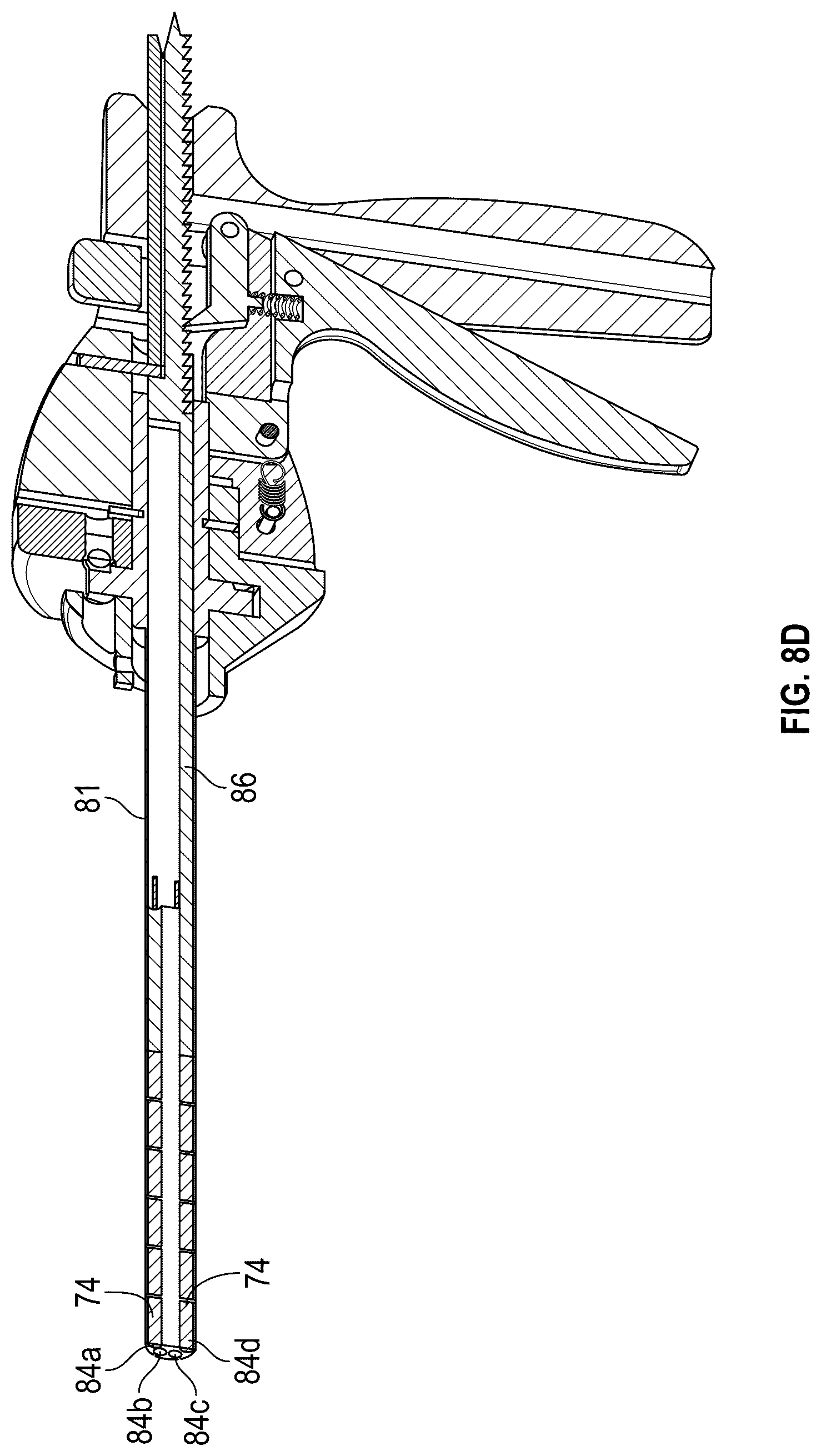 Patent US12102367 Figure 10 – Method, composition, and apparatus for stabilization of vertebral bodies