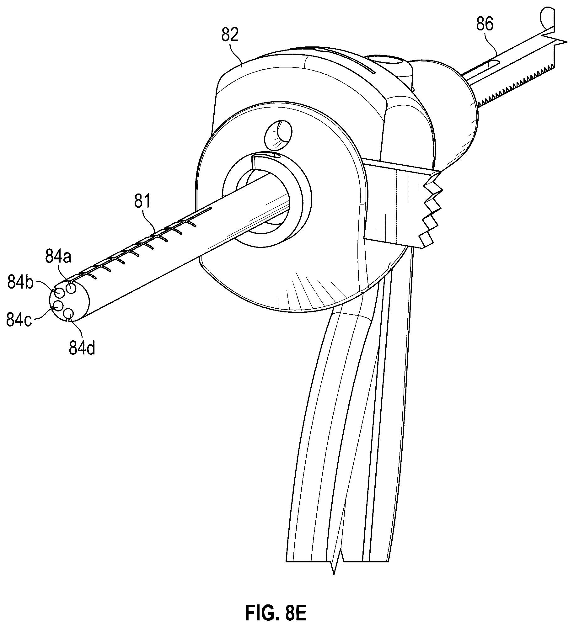Patent US12102367 Figure 11 – Method, composition, and apparatus for stabilization of vertebral bodies