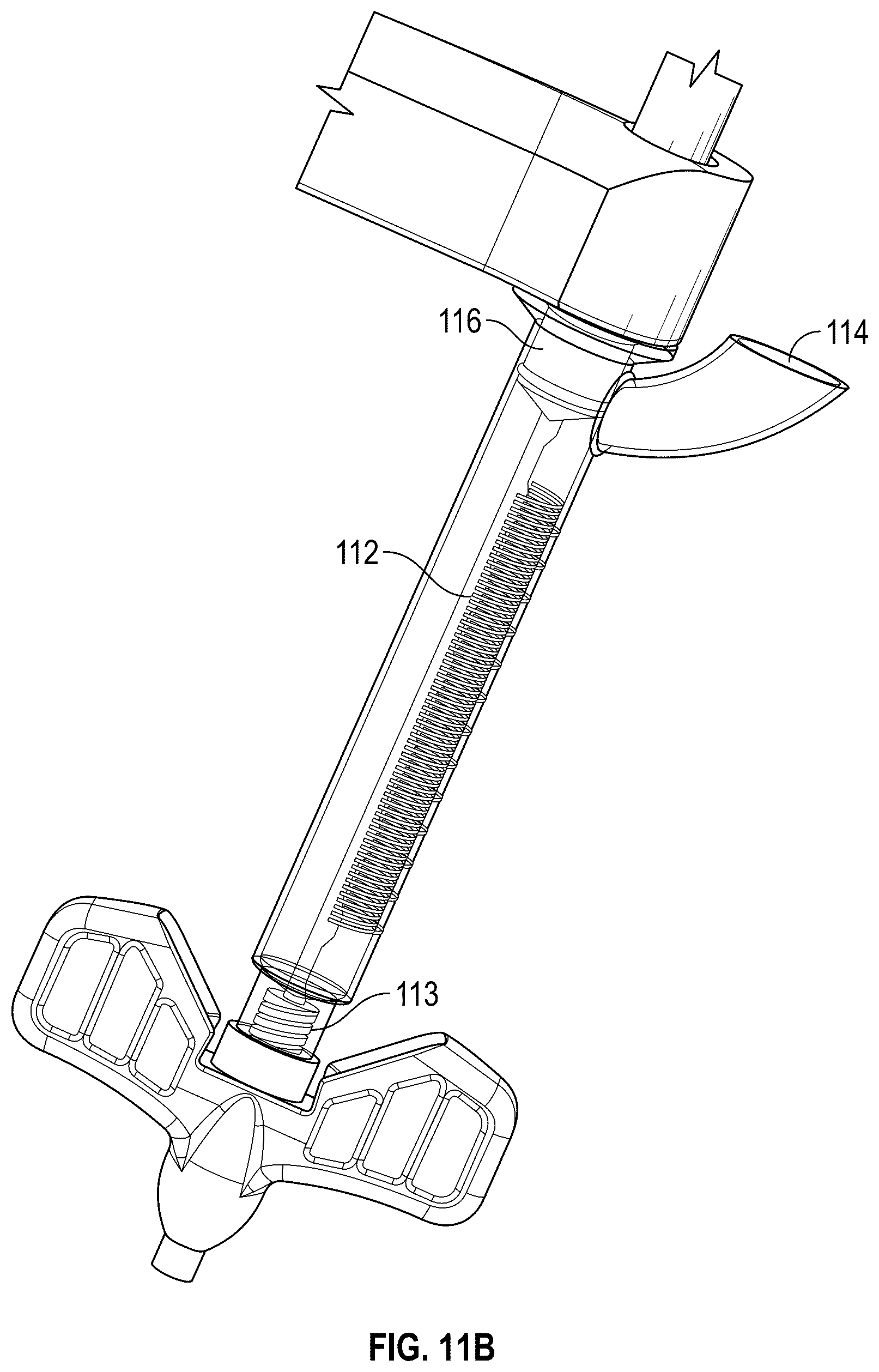 Patent US12102367 Figure 17 – Method, composition, and apparatus for stabilization of vertebral bodies