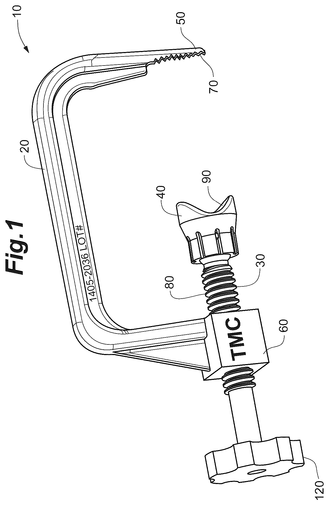 Patent US12102368 — Bone positioning guide — Figure 1