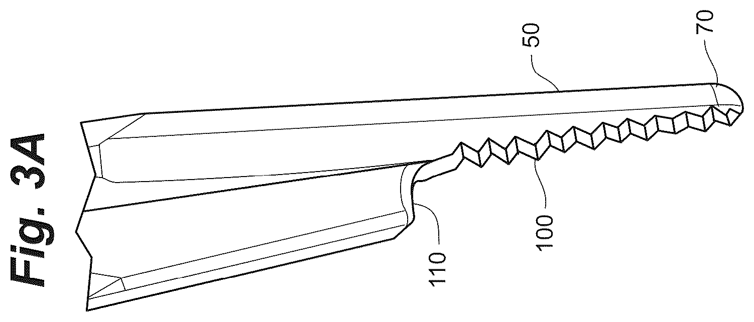 Patent US12102368 Figure 3 – Bone positioning guide