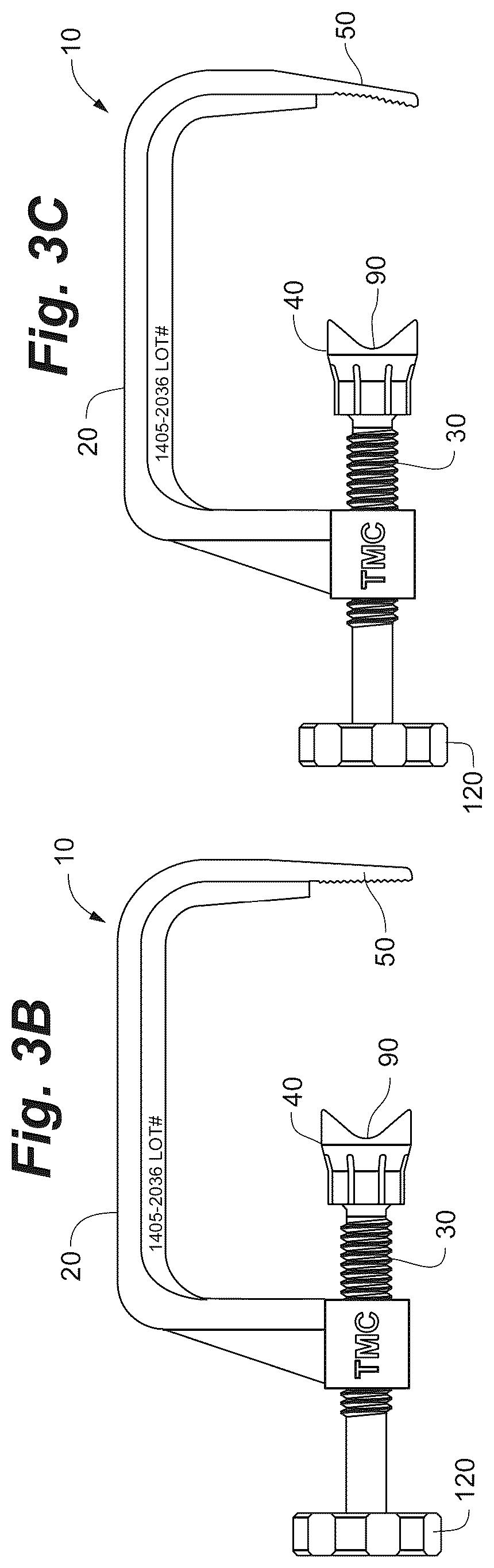 Patent US12102368 Figure 4 – Bone positioning guide