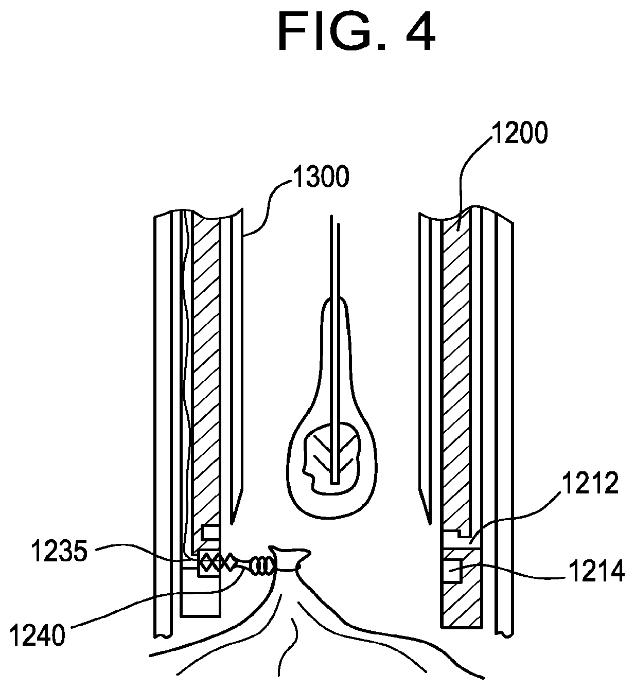 Patent US12102372 Figure 3 – Tissue resection apparatus
