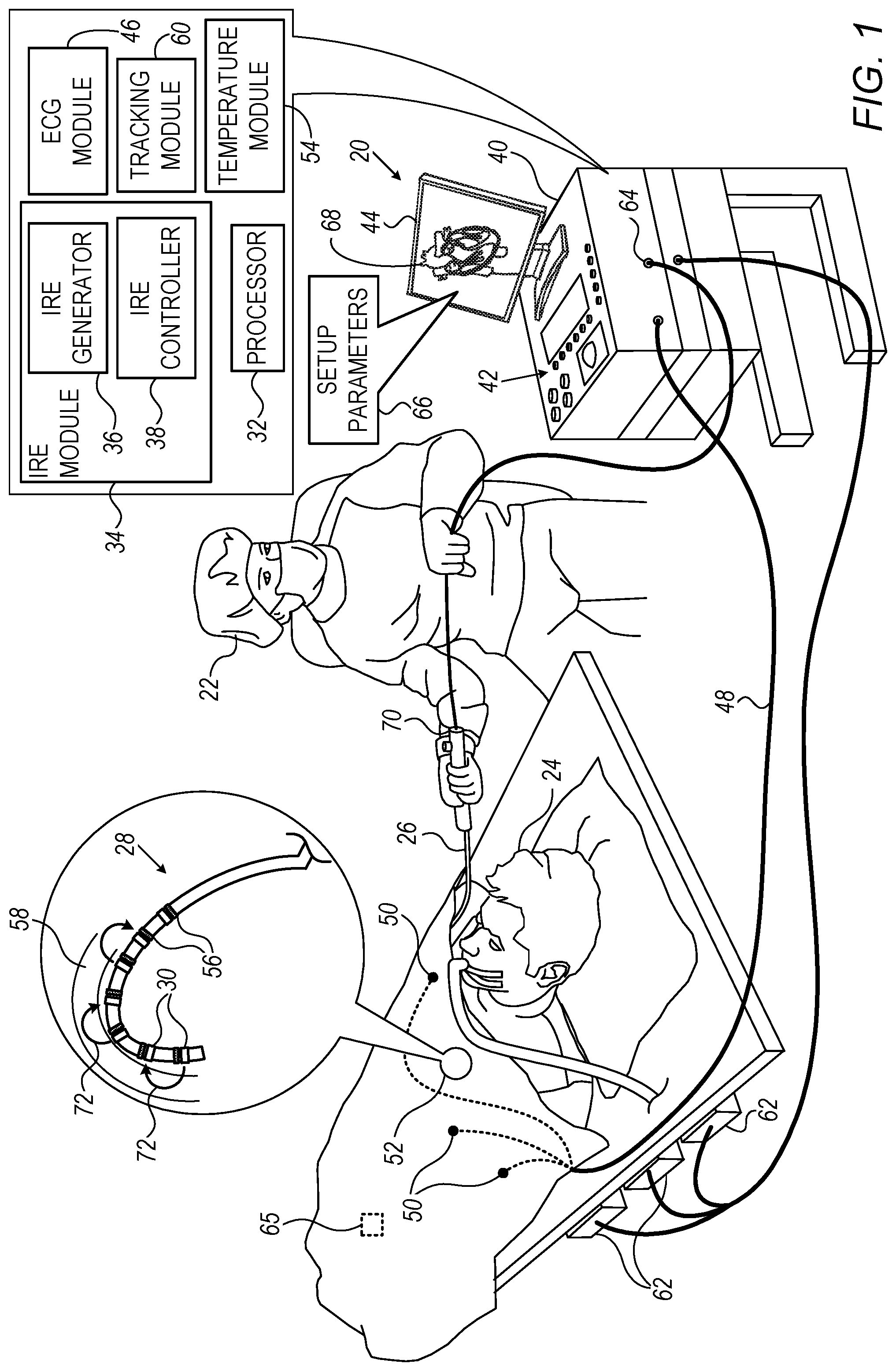 Patent US12102374 — Pulse generator for irreversible electroporation with switchable pulse application — Figure 1
