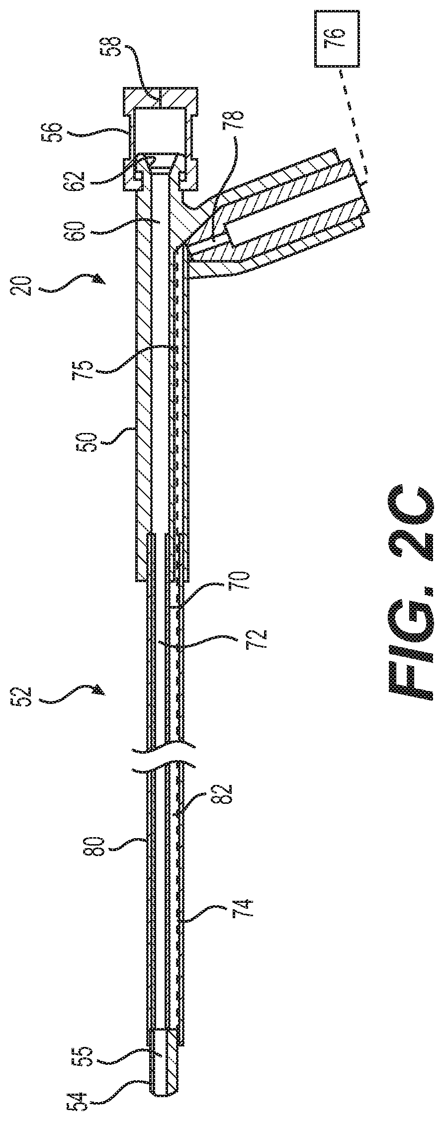 Patent US12102375 Figure 4 – Systems and methods for tissue coagulation