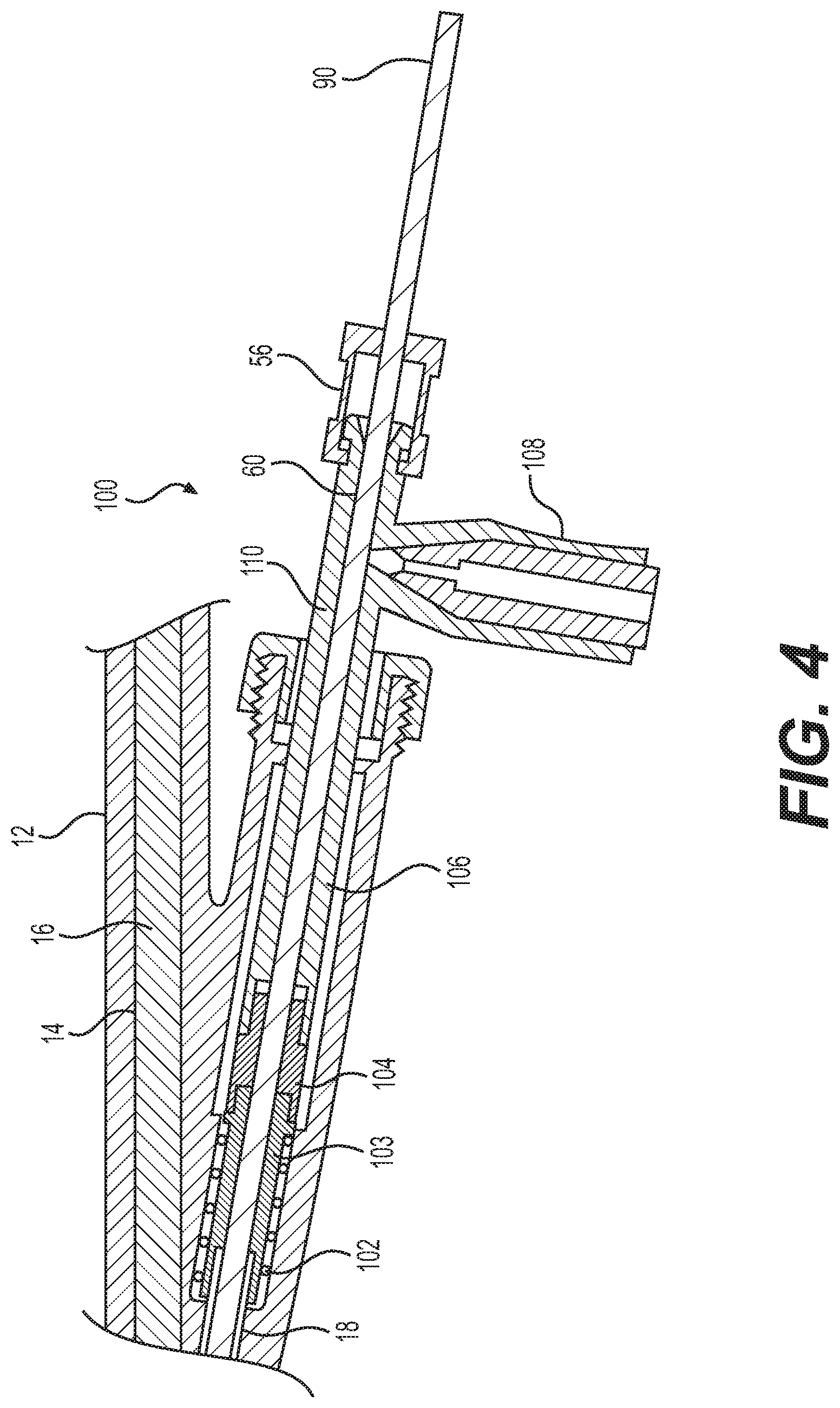Patent US12102375 Figure 6 – Systems and methods for tissue coagulation