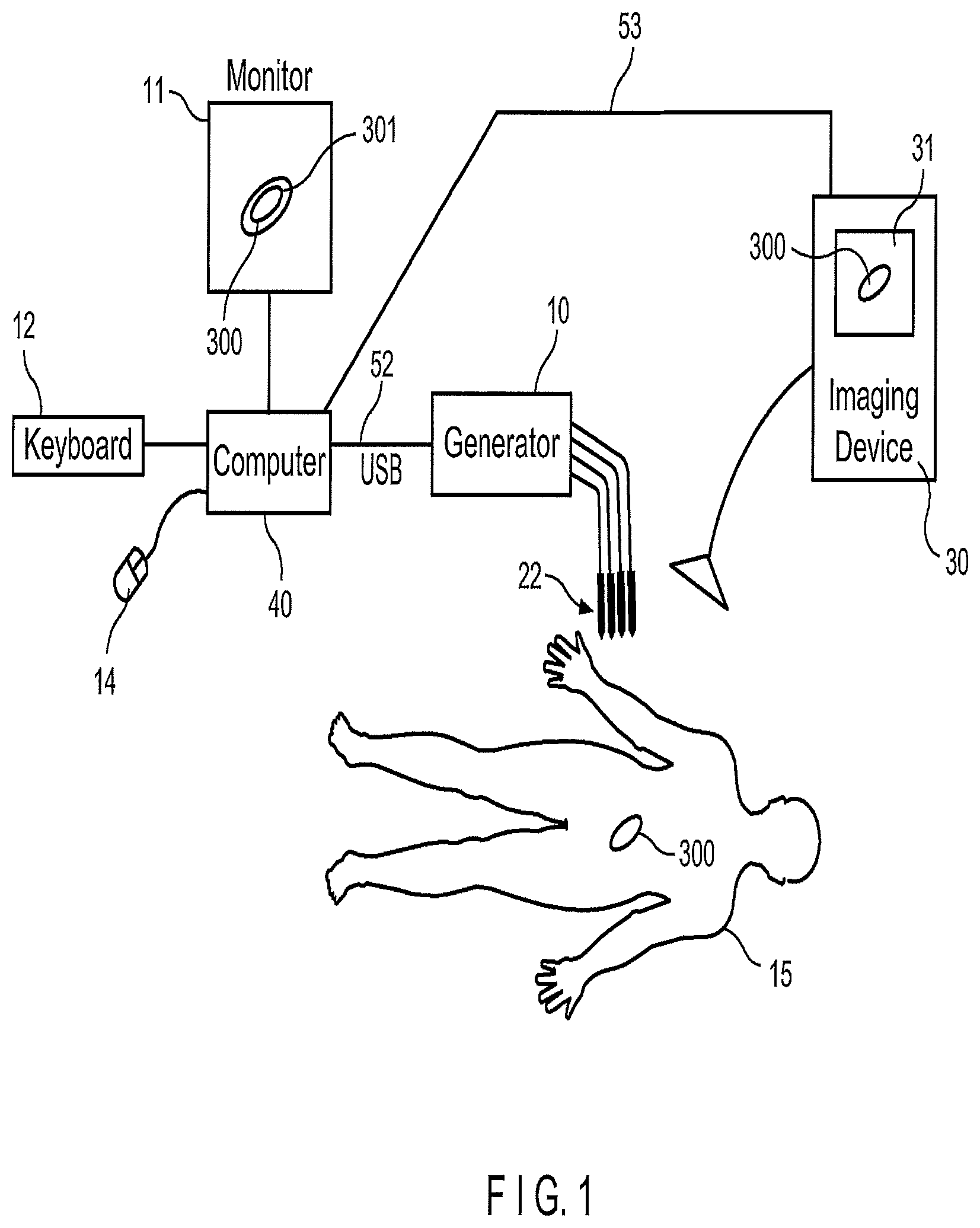 Patent US12102376 — System and method for increasing a target zone for electrical ablation — Figure 1