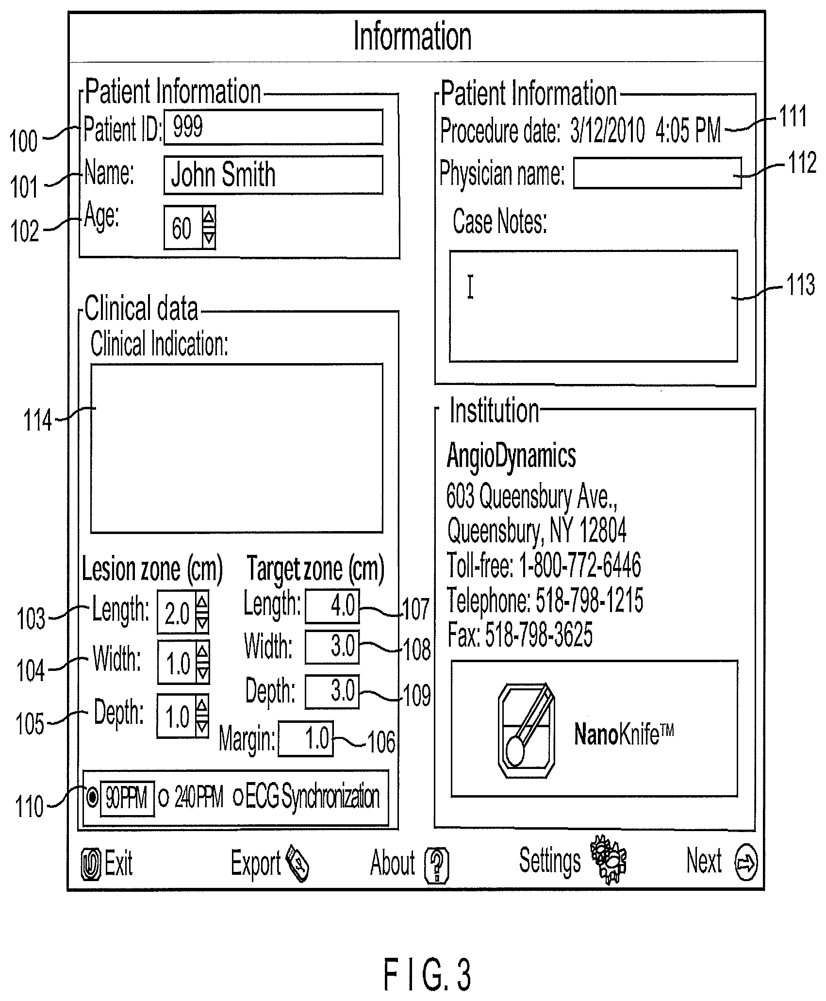 Patent US12102376 Figure 3 – System and method for increasing a target zone for electrical ablation
