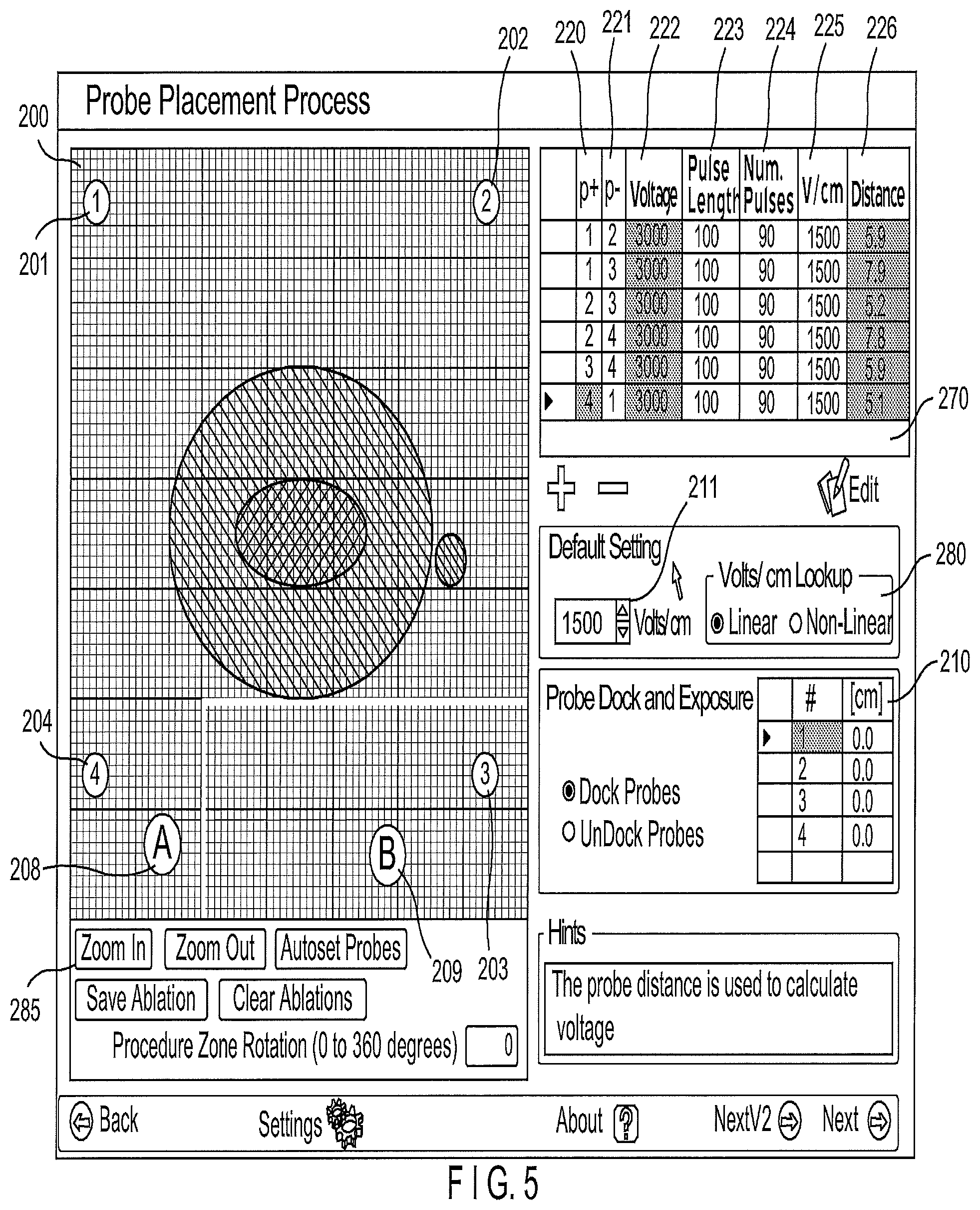 Patent US12102376 Figure 5 – System and method for increasing a target zone for electrical ablation