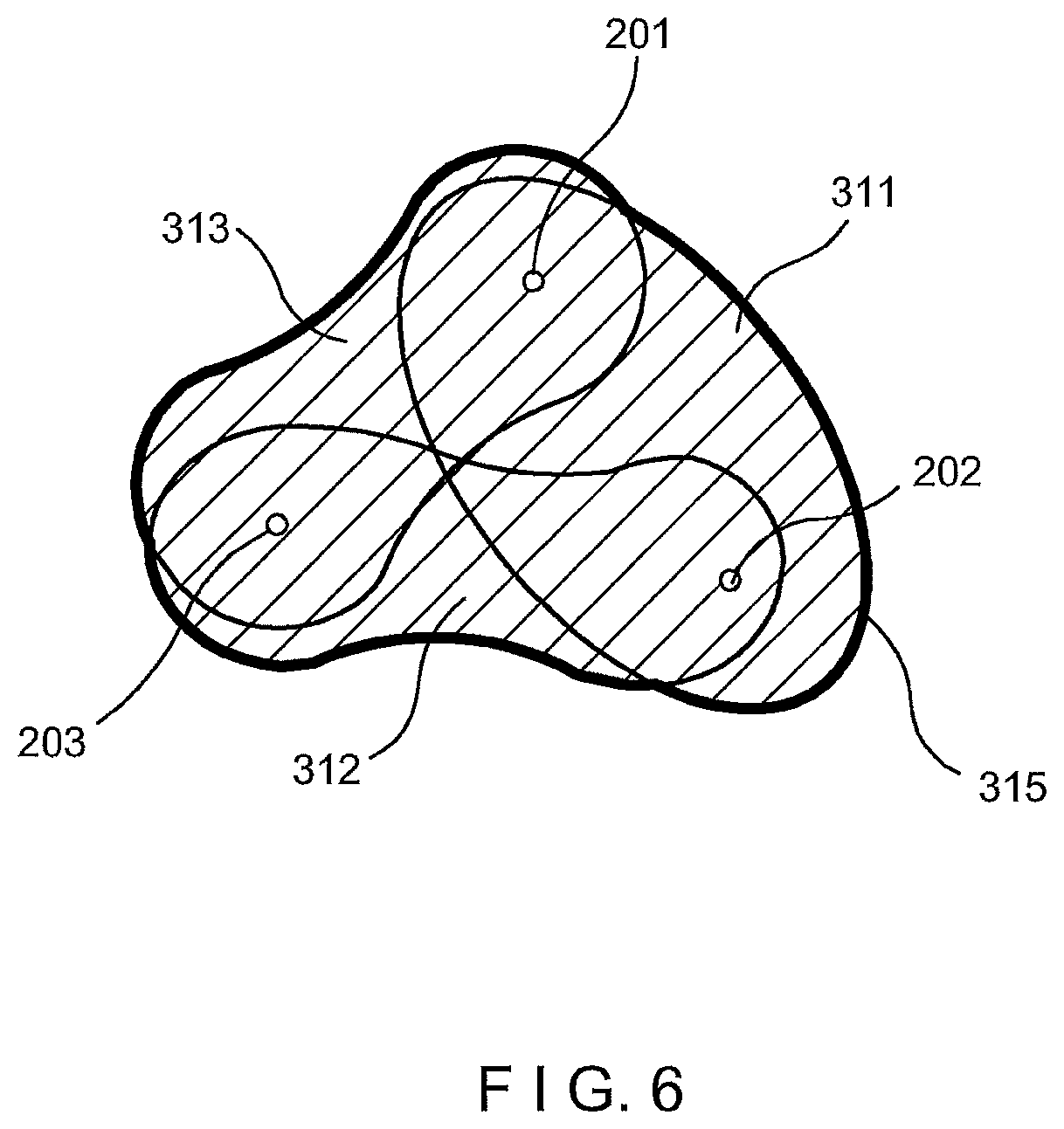 Patent US12102376 Figure 6 – System and method for increasing a target zone for electrical ablation