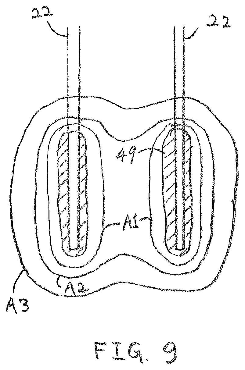 Patent US12102376 Figure 9 – System and method for increasing a target zone for electrical ablation
