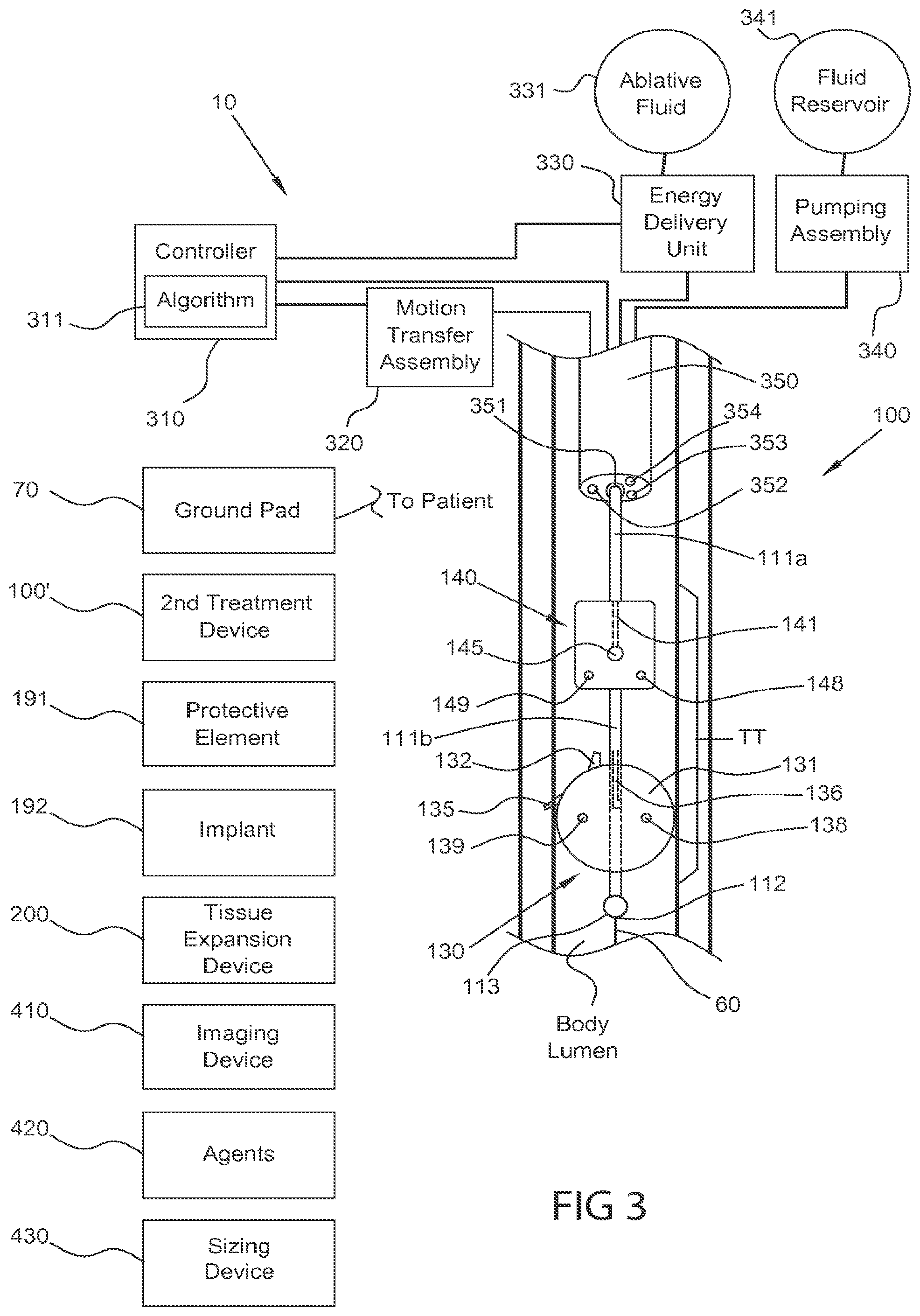 Patent US12102380 Figure 5 – Methods, systems and devices for reducing the luminal surface area of the gastrointestinal tract