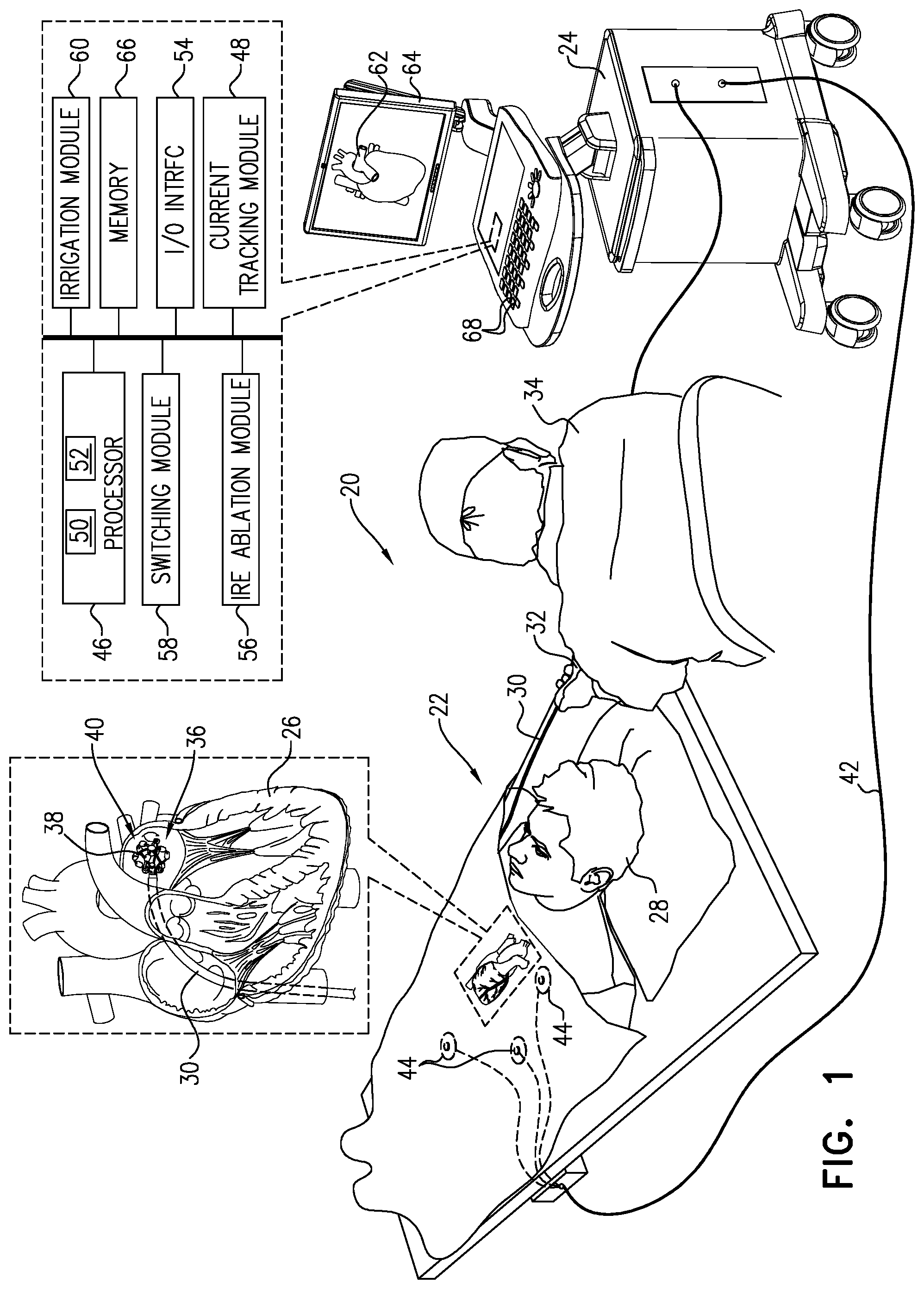 Patent US12102382 Figure 1 – Biased electrodes for improved tissue contact and current delivery