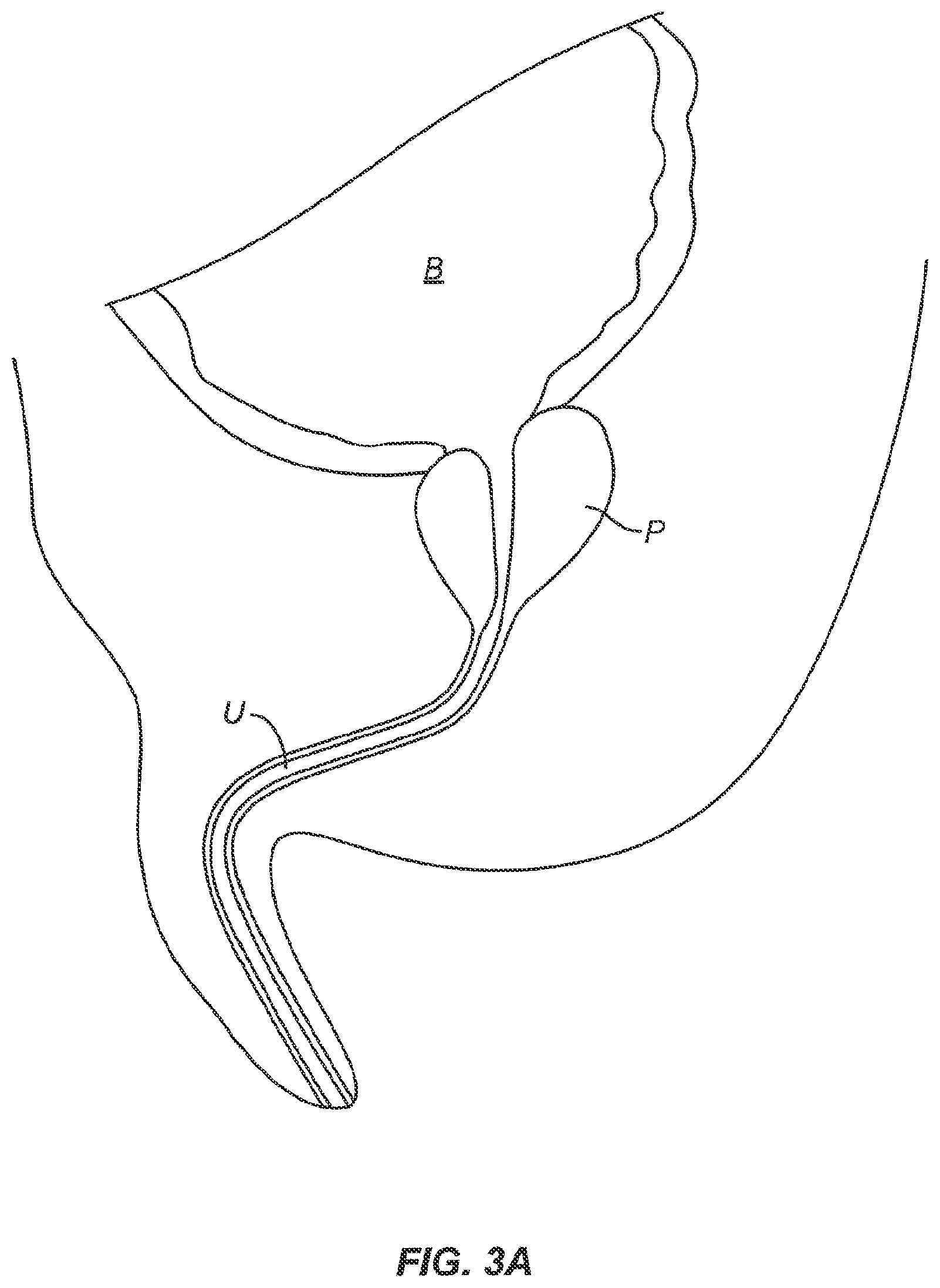 Patent US12102383 Figure 3 – Tissue resection device with motors and control circuitry