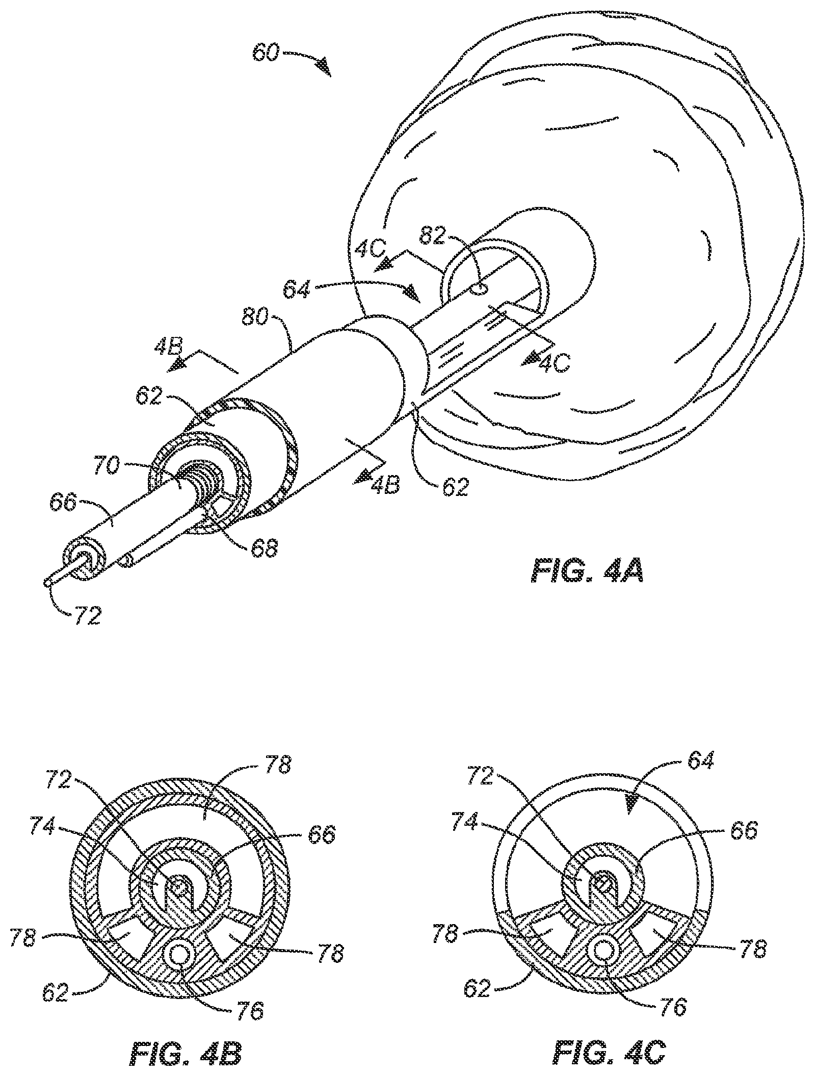 Patent US12102383 Figure 6 – Tissue resection device with motors and control circuitry