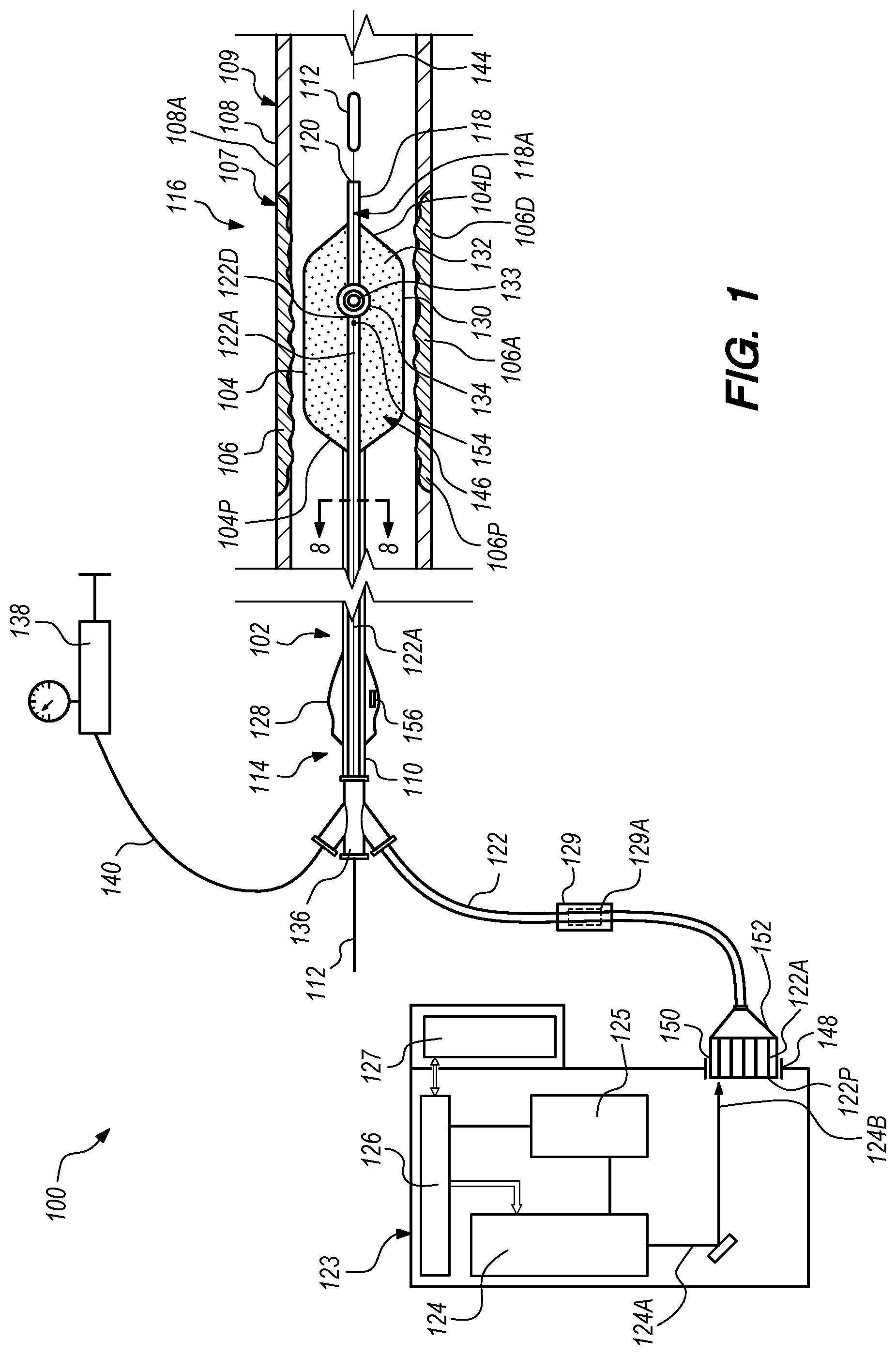 Patent US12102384 Figure 1 – Dynamic intravascular lithotripsy device with movable energy guide