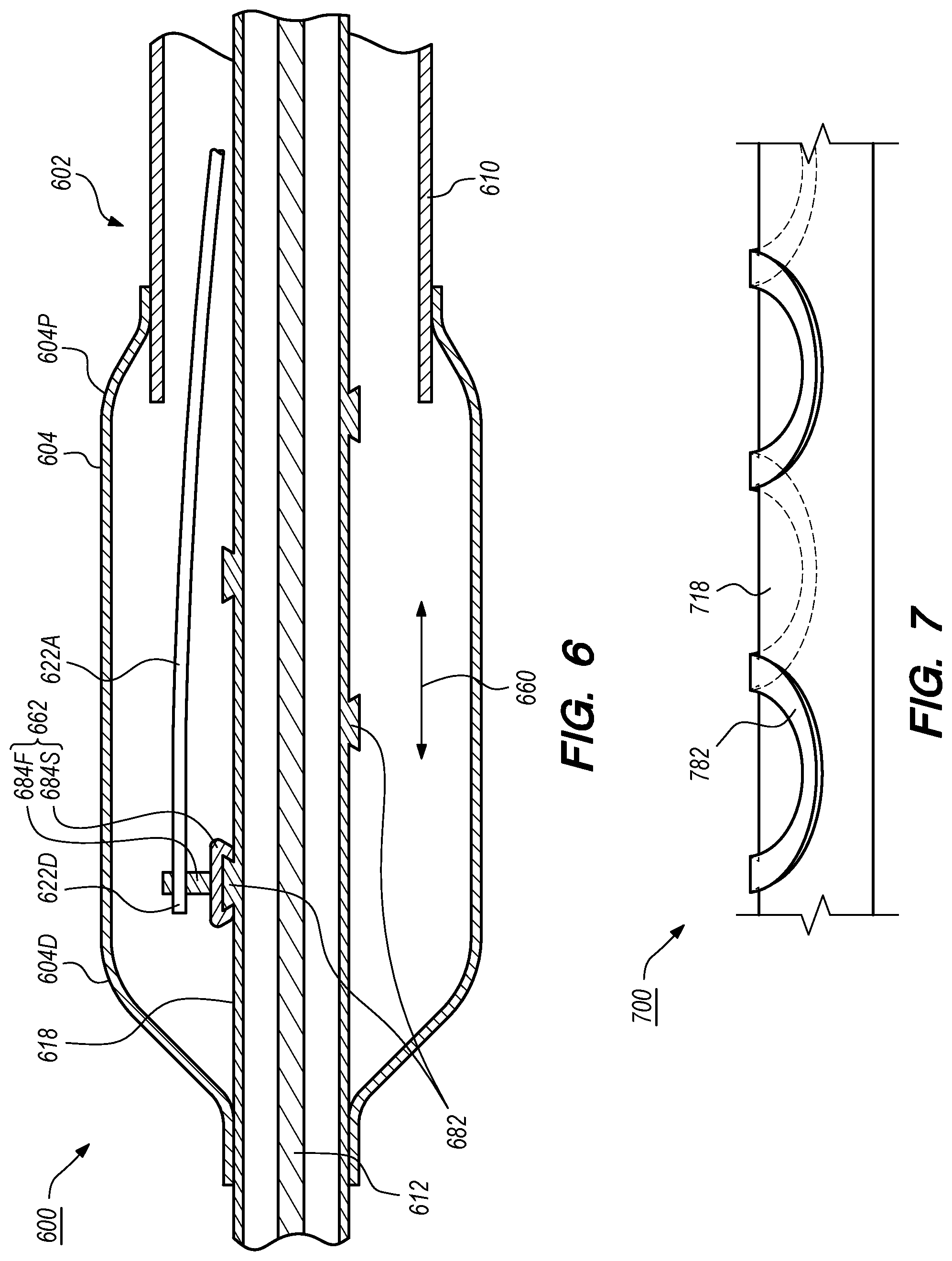 Patent US12102384 Figure 6 – Dynamic intravascular lithotripsy device with movable energy guide