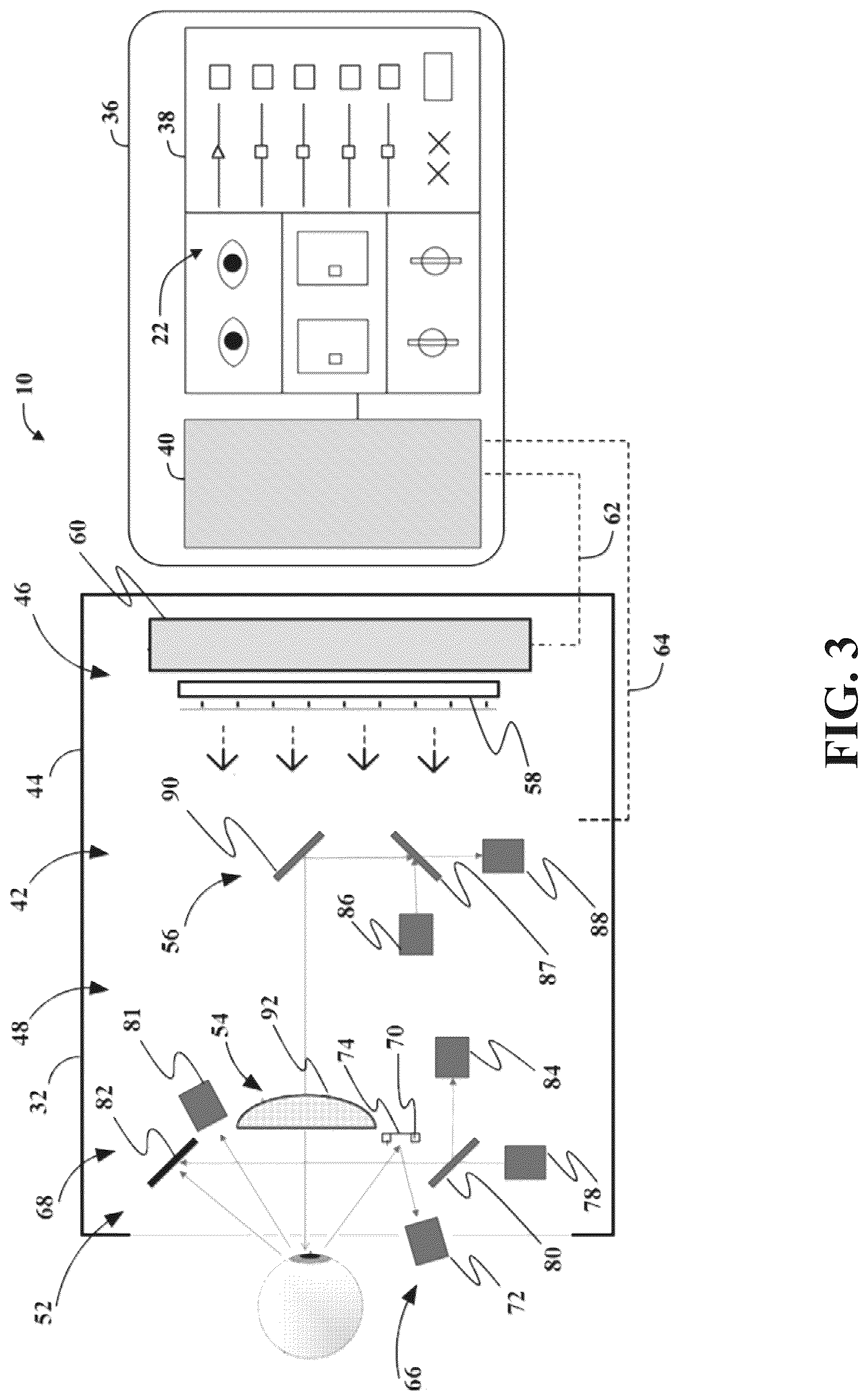 Patent US12102387 Figure 3 – System and methods for use in vision assessment to determine refractive errors and neurodegenerative disorders by ocular biomarking features