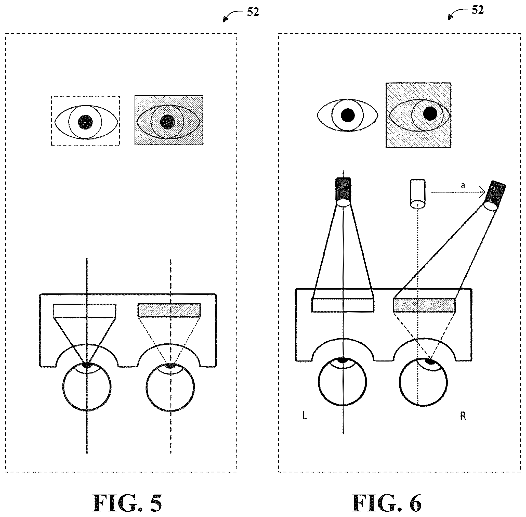 Patent US12102387 Figure 5 – System and methods for use in vision assessment to determine refractive errors and neurodegenerative disorders by ocular biomarking features
