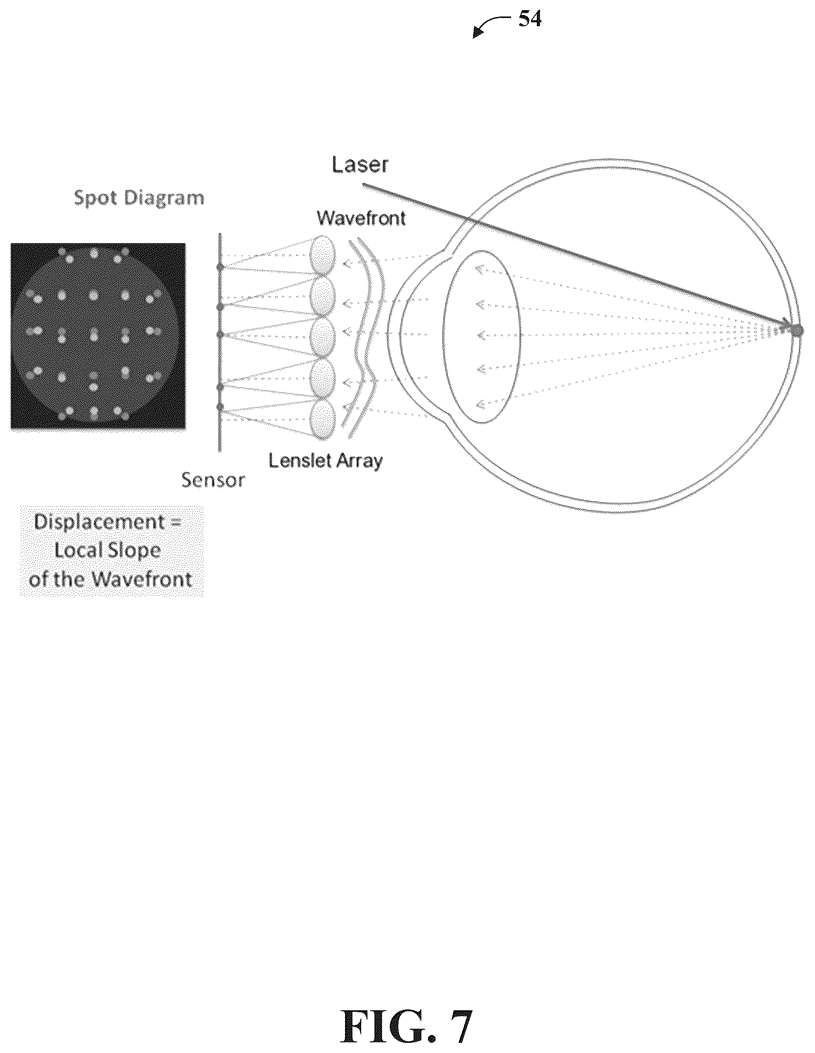 Patent US12102387 Figure 6 – System and methods for use in vision assessment to determine refractive errors and neurodegenerative disorders by ocular biomarking features