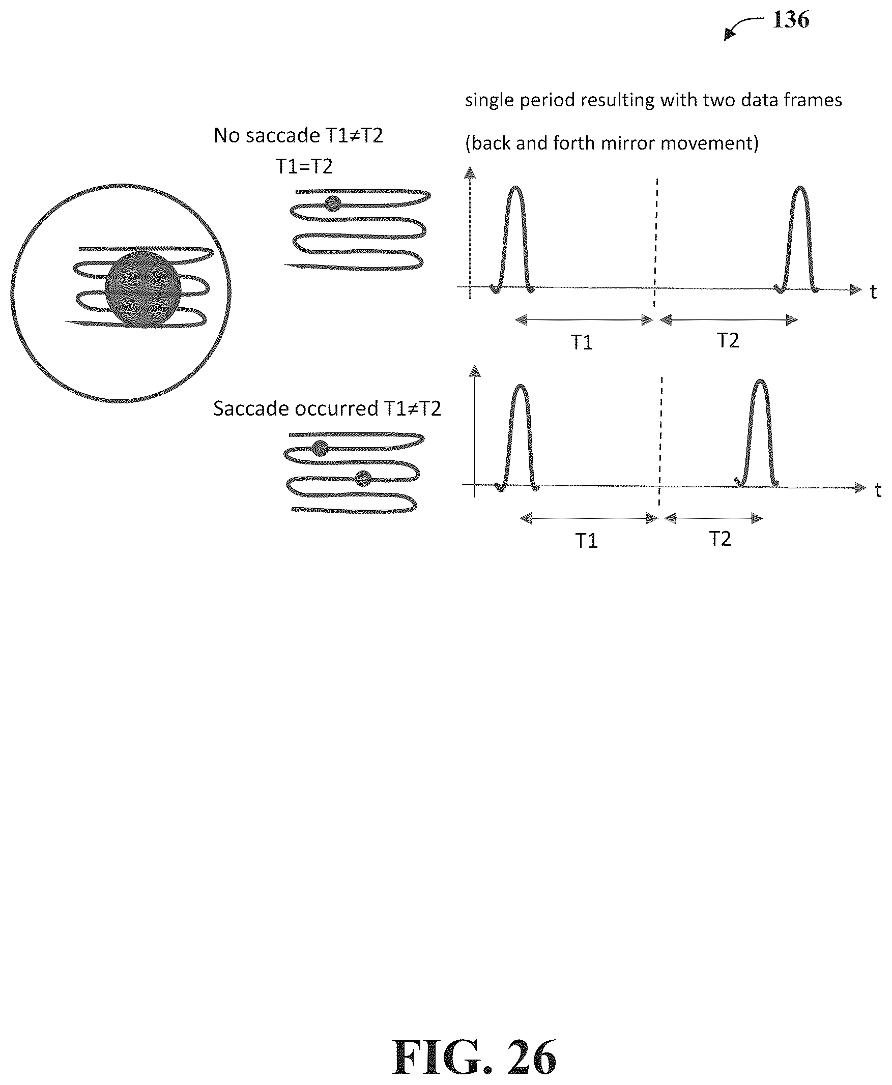 Patent US12102387 Figure 19 – System and methods for use in vision assessment to determine refractive errors and neurodegenerative disorders by ocular biomarking features