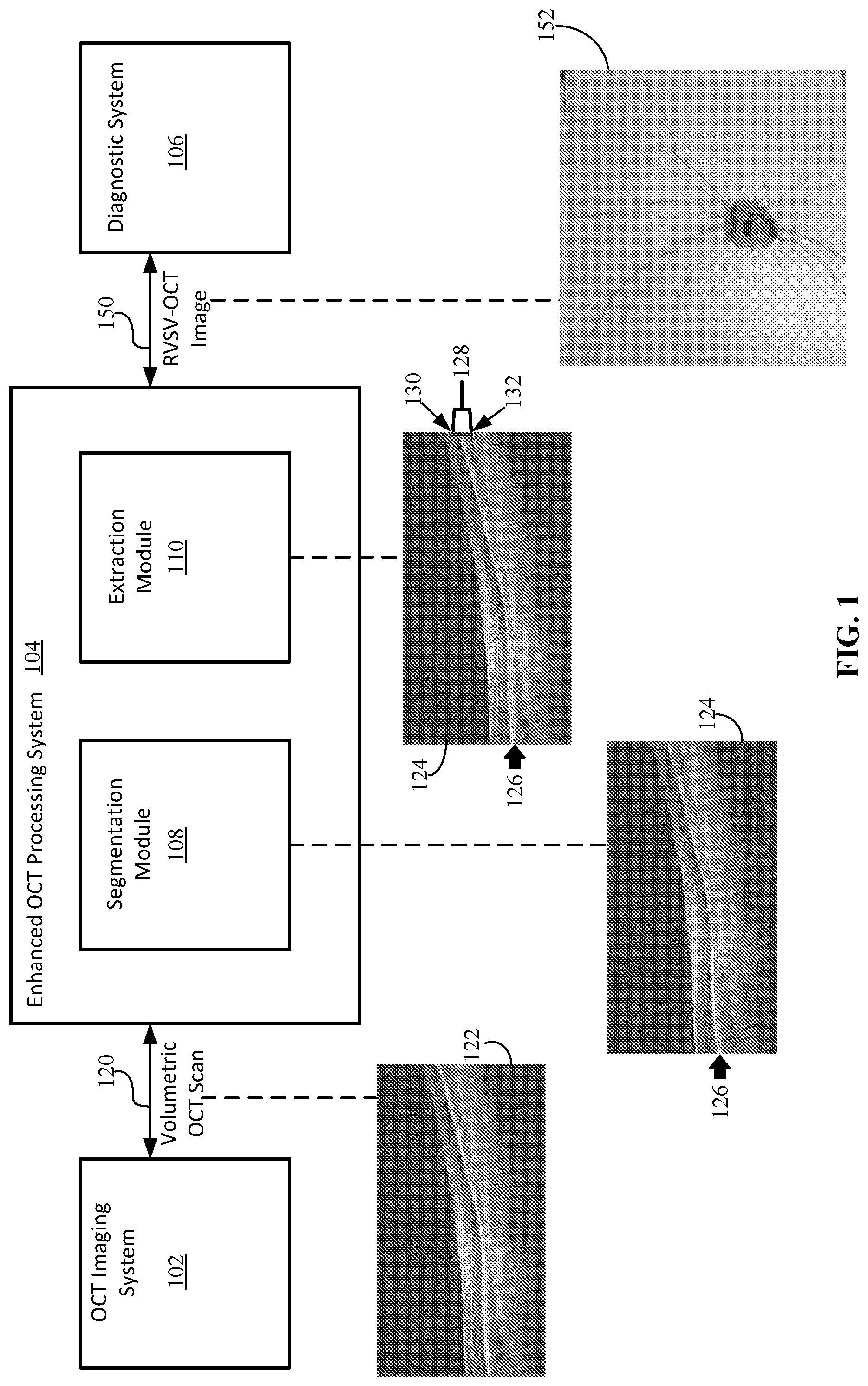 Patent US12102389 Figure 1 – En face retinal vessel shadow view optical coherence tomography images