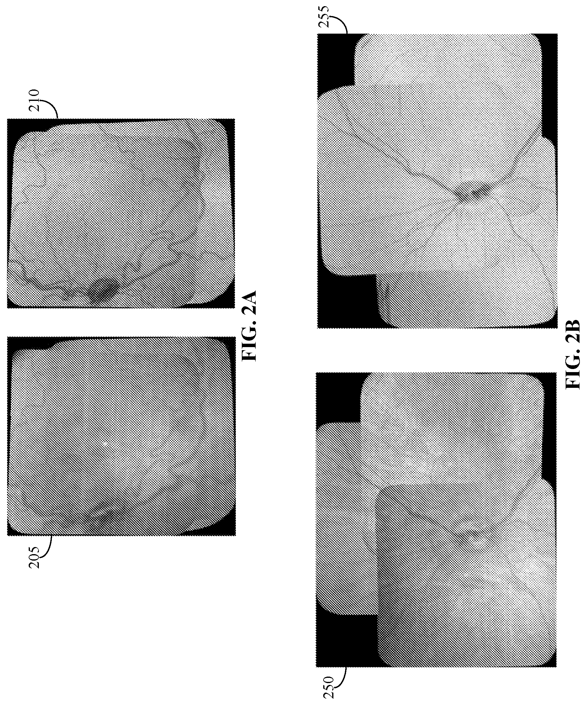 Patent US12102389 Figure 2 – En face retinal vessel shadow view optical coherence tomography images