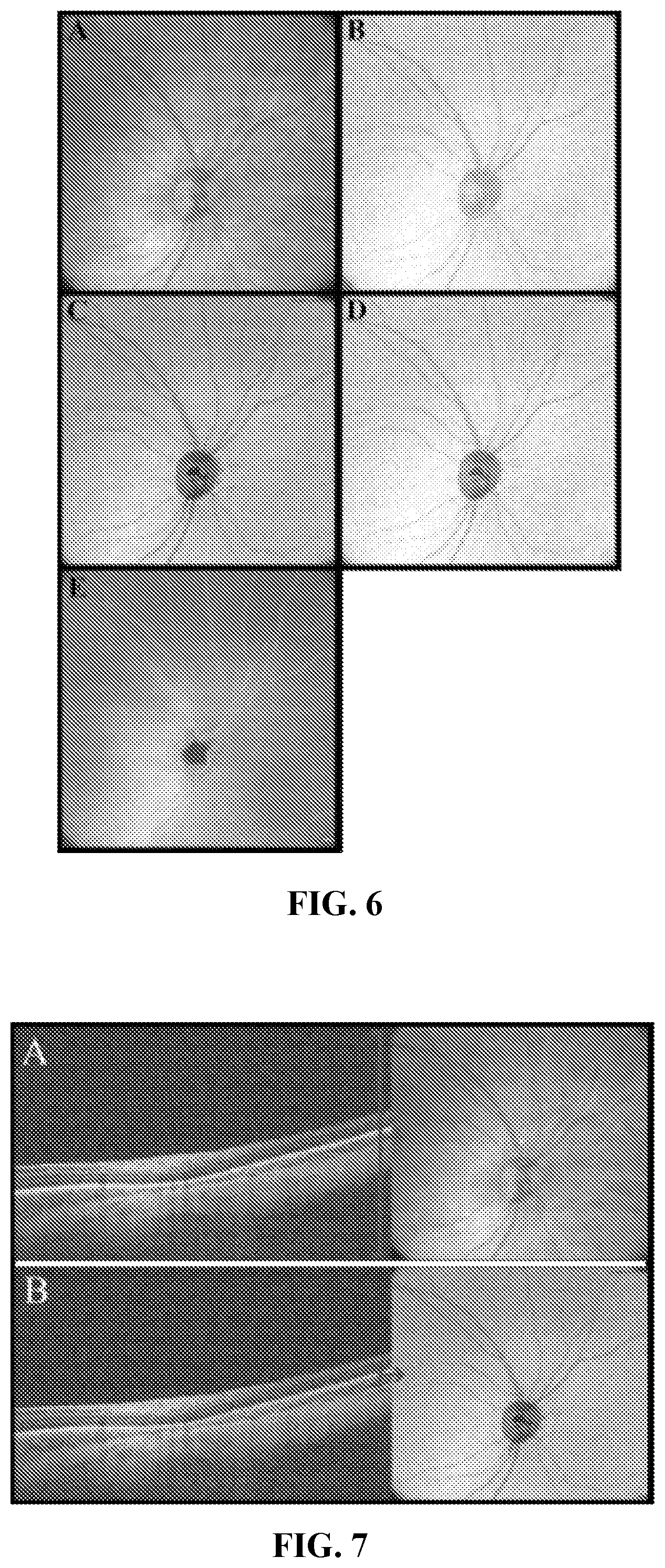 Patent US12102389 Figure 6 – En face retinal vessel shadow view optical coherence tomography images