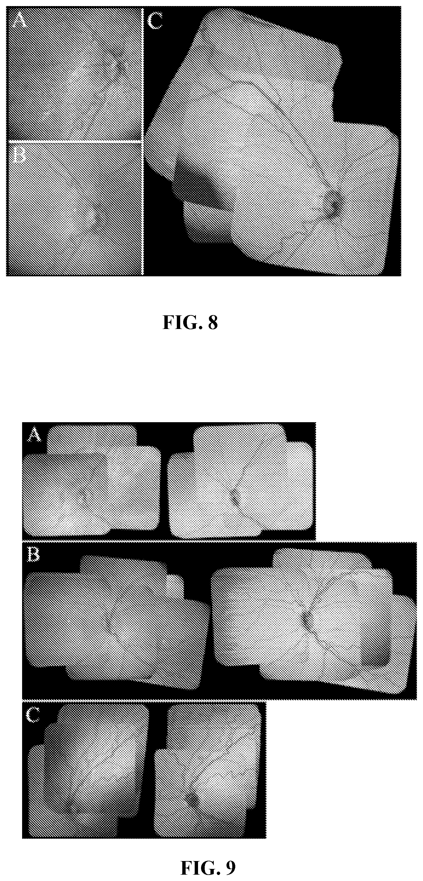 Patent US12102389 Figure 7 – En face retinal vessel shadow view optical coherence tomography images