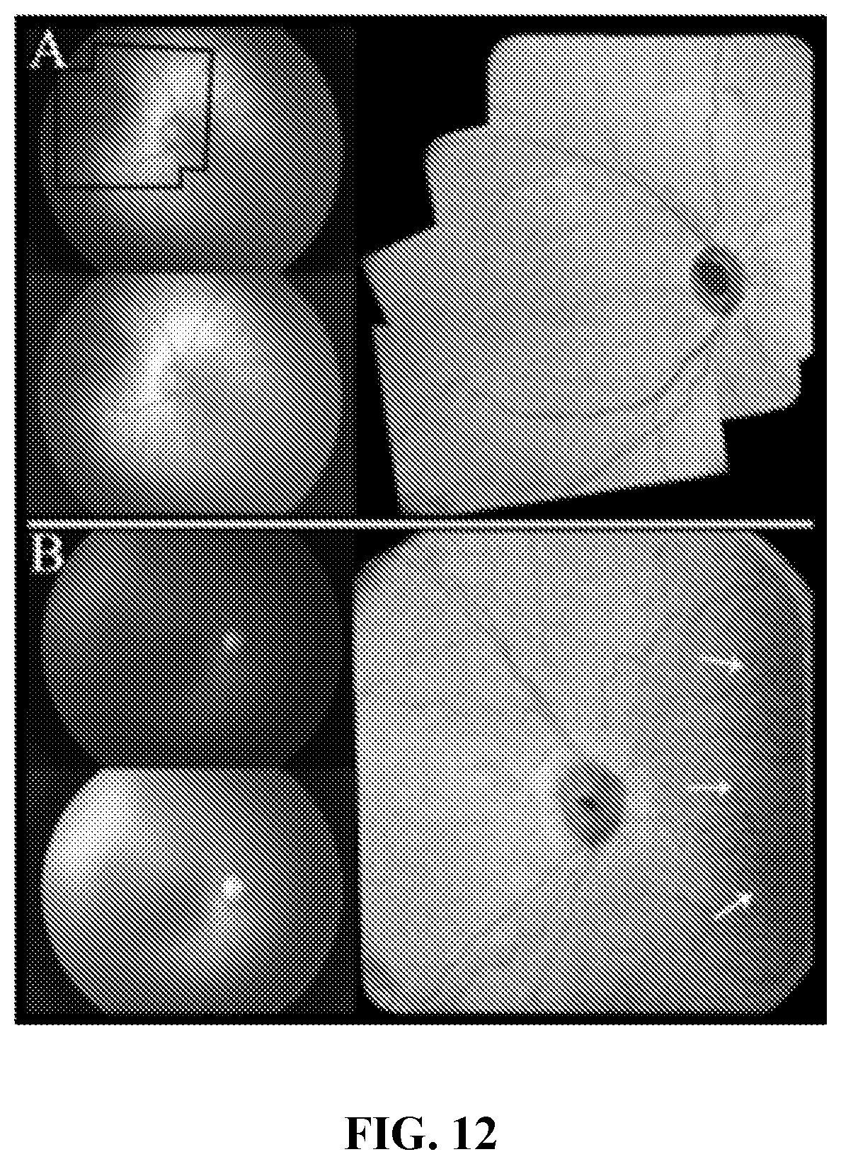 Patent US12102389 Figure 9 – En face retinal vessel shadow view optical coherence tomography images