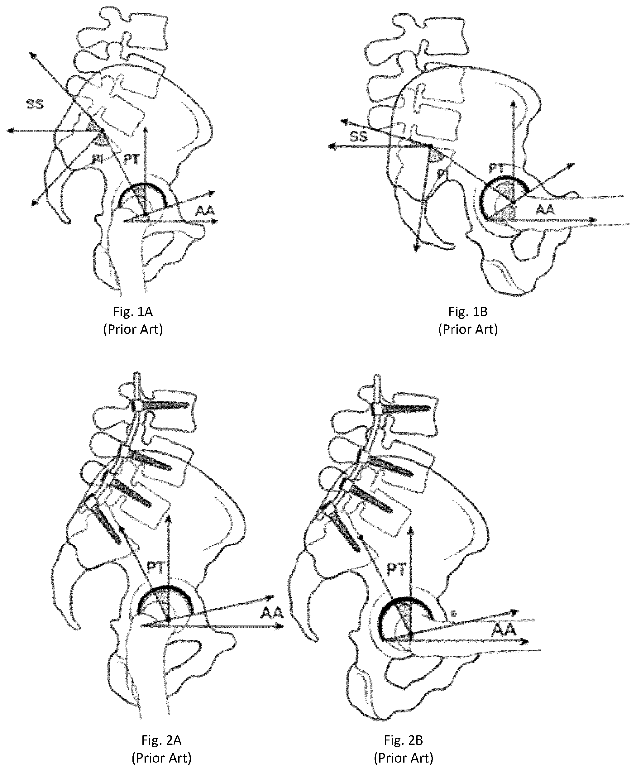 Patent US12102390 Figure 1 – System and method for pre-planning a procedure