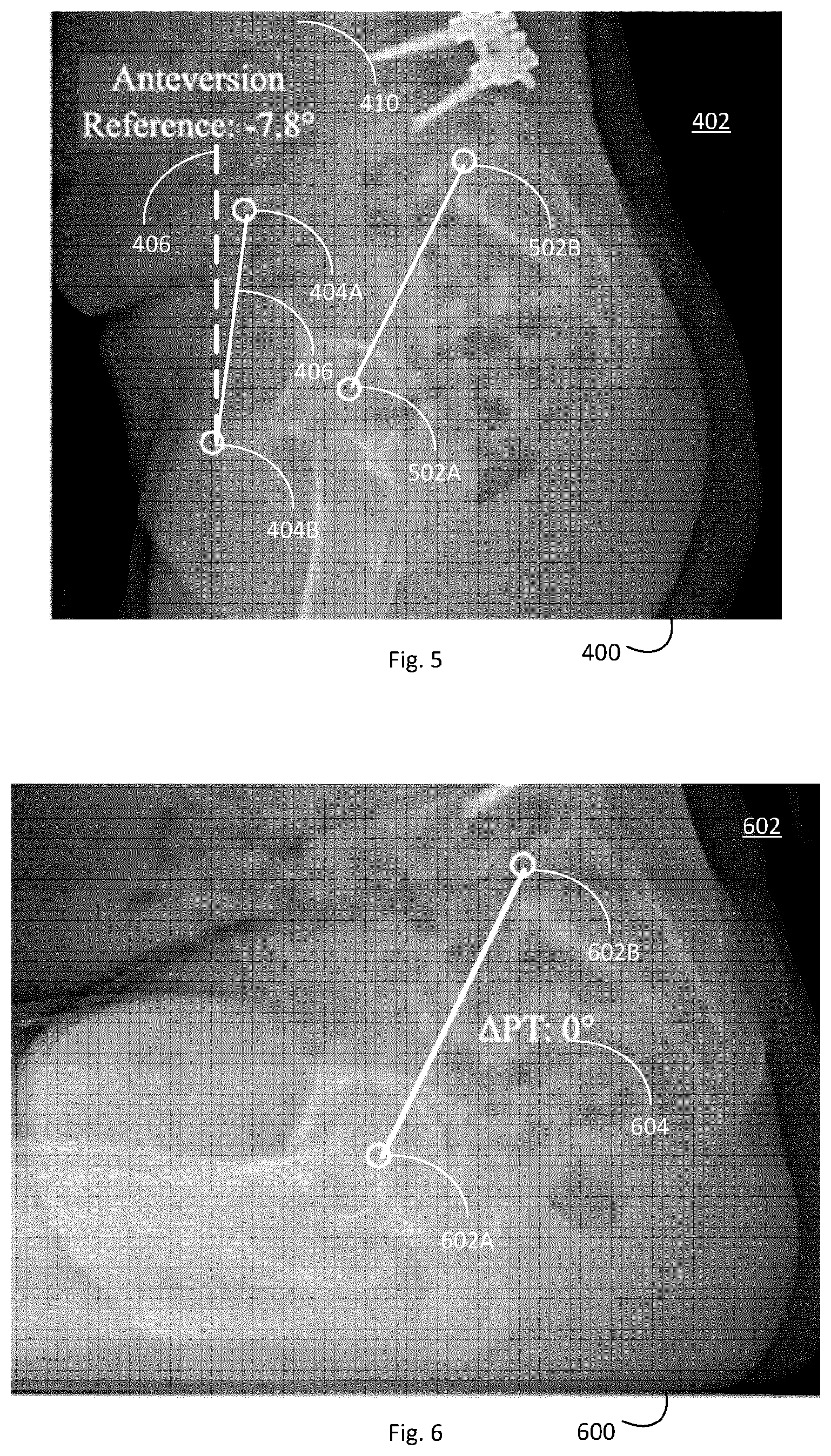 Patent US12102390 Figure 4 – System and method for pre-planning a procedure