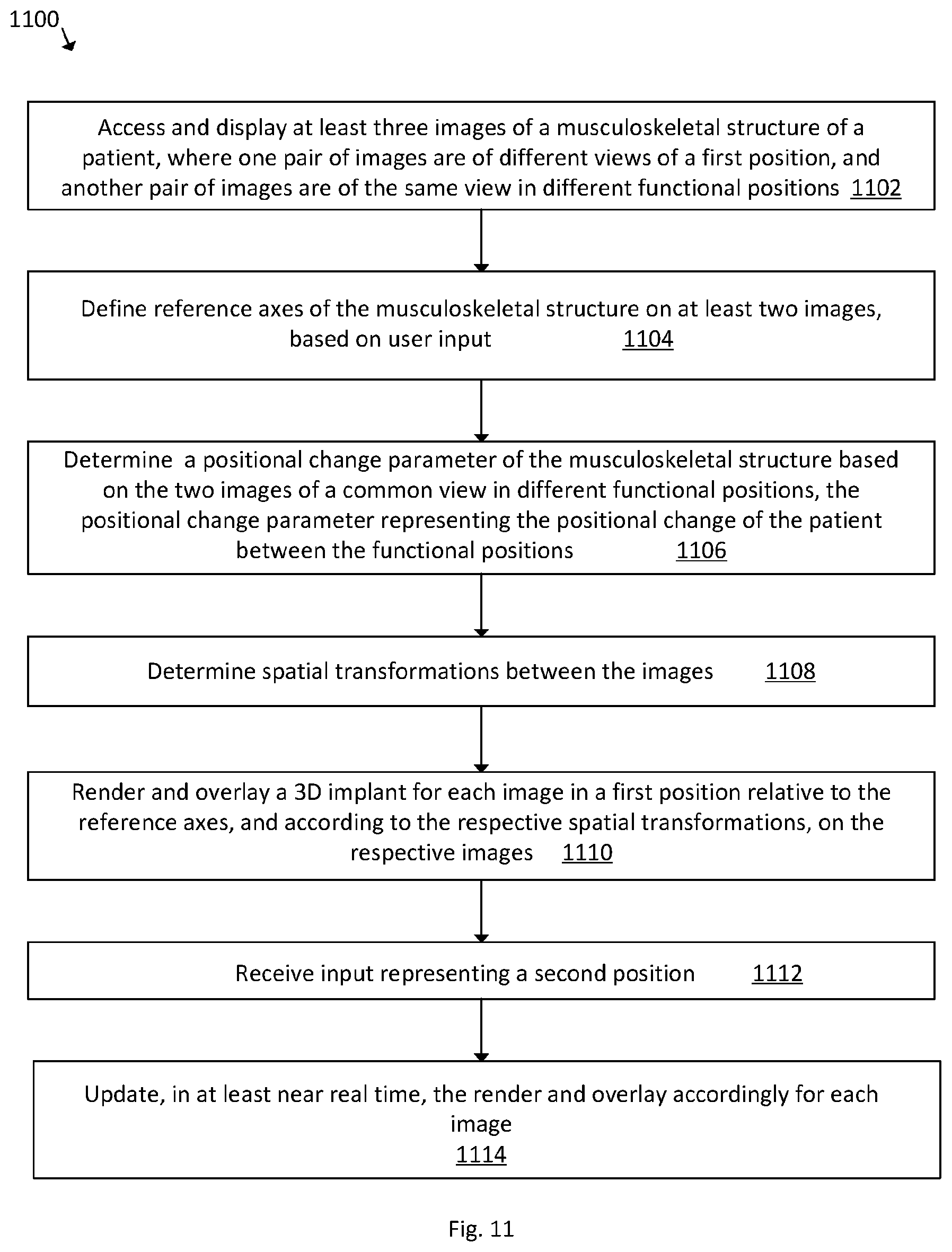 Patent US12102390 Figure 9 – System and method for pre-planning a procedure