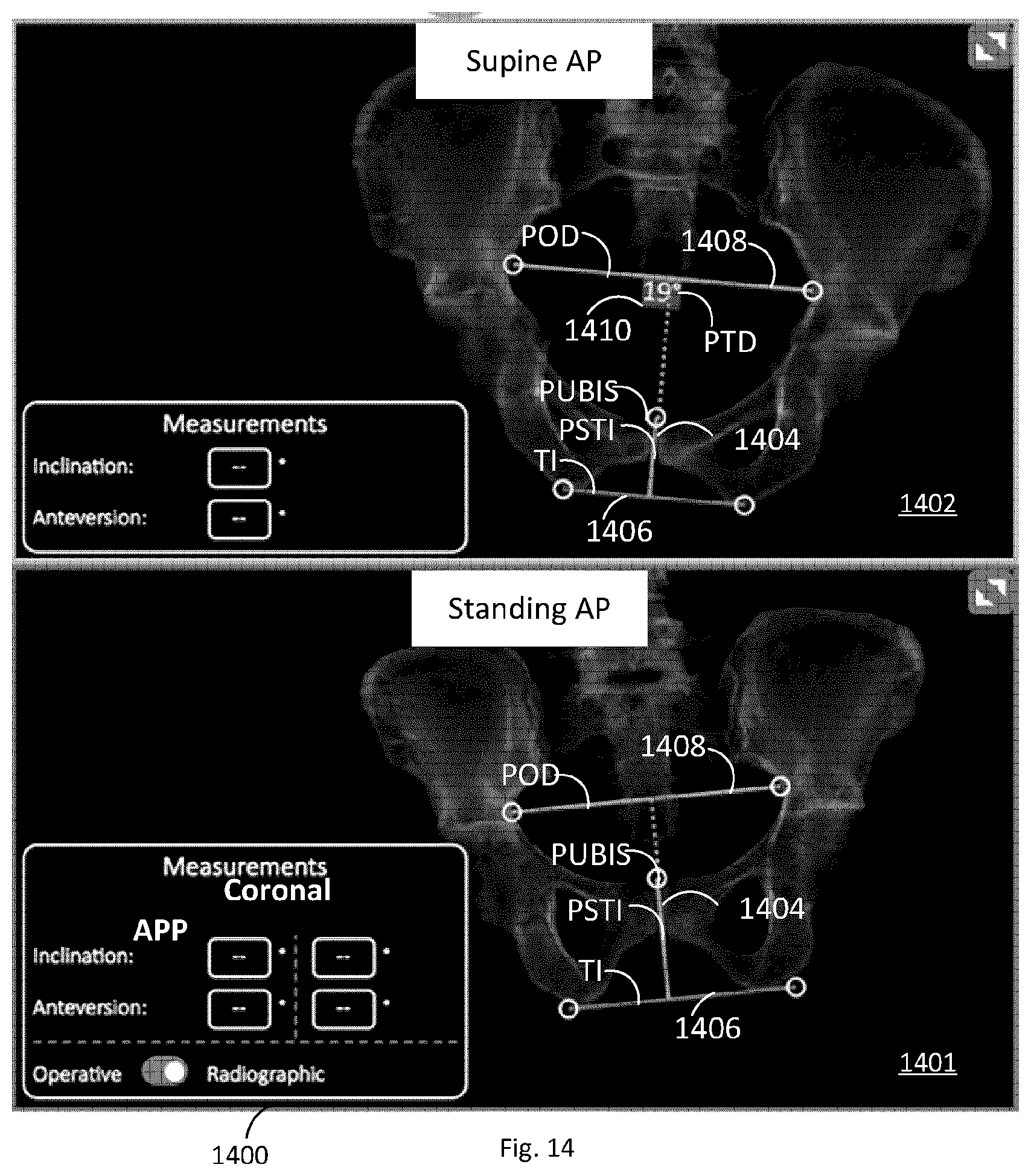 Patent US12102390 Figure 12 – System and method for pre-planning a procedure