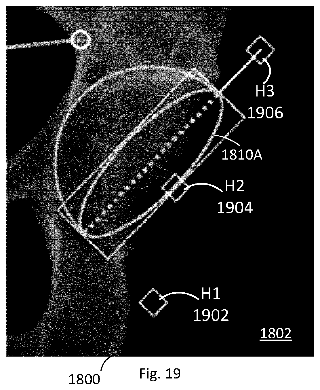 Patent US12102390 Figure 17 – System and method for pre-planning a procedure