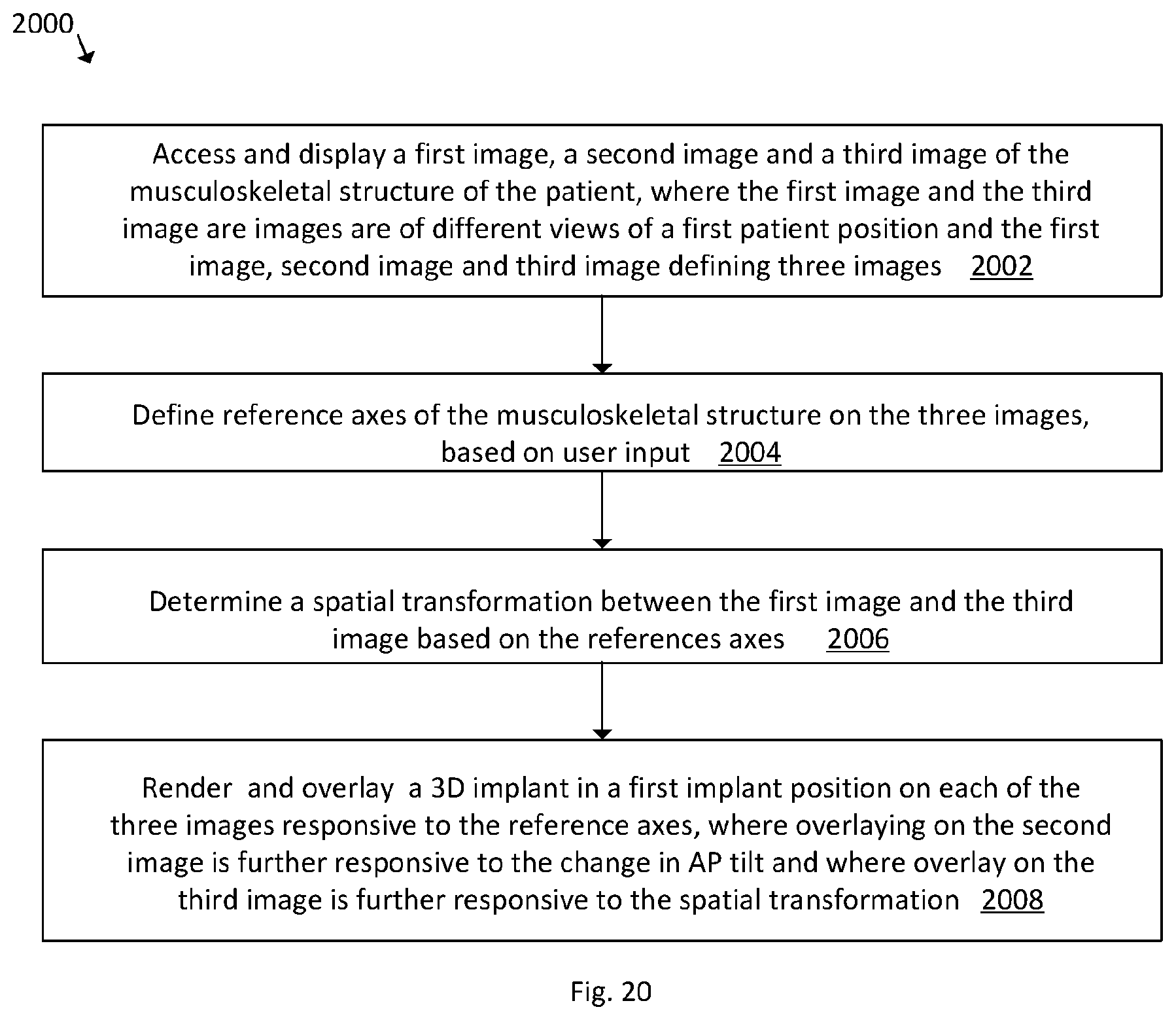 Patent US12102390 Figure 18 – System and method for pre-planning a procedure