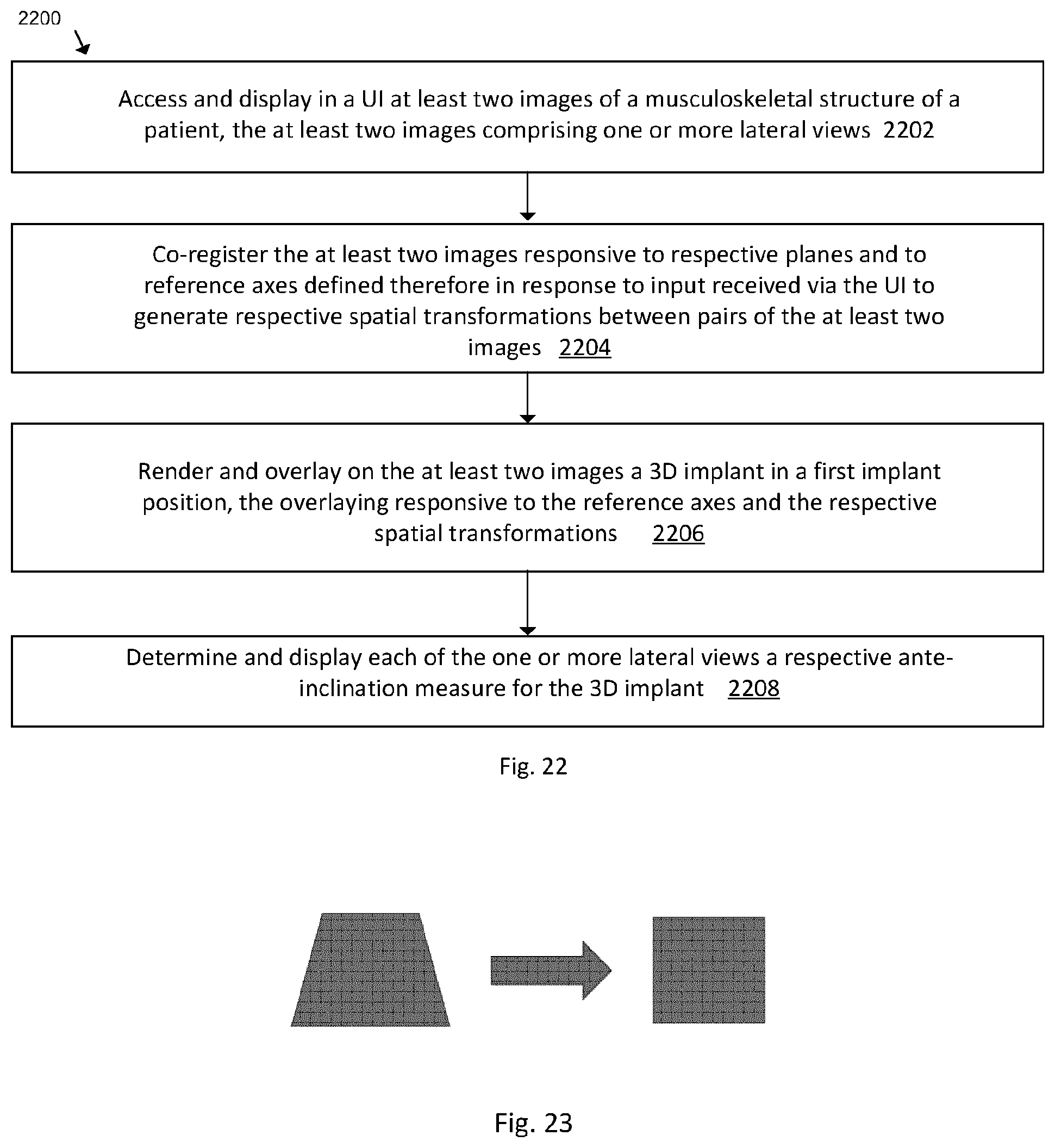 Patent US12102390 Figure 20 – System and method for pre-planning a procedure