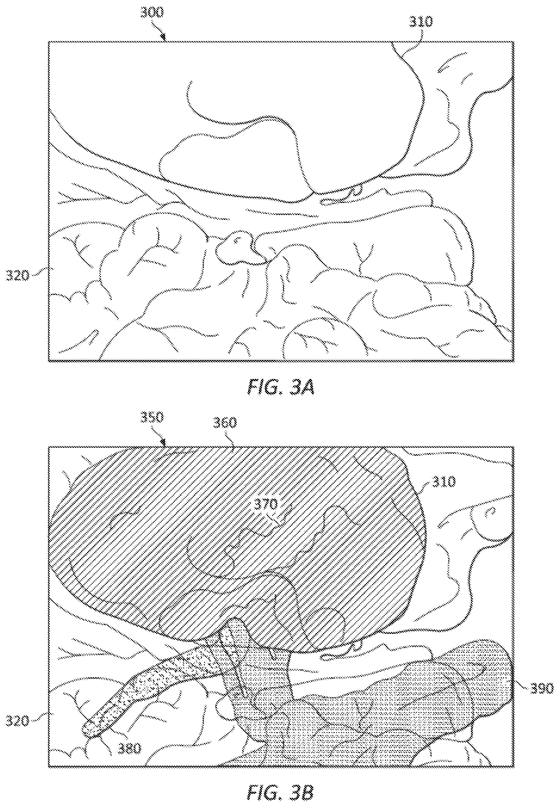 Patent US12102391 Figure 3 – System and method for registration and coordinated manipulation of augmented reality image components