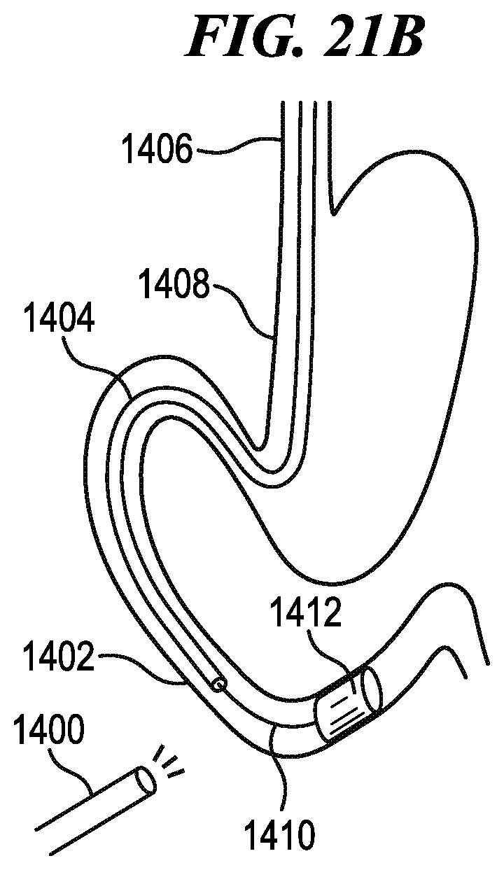 Patent US12102392 Figure 15 – Methods and systems for controlling cooperative surgical instruments