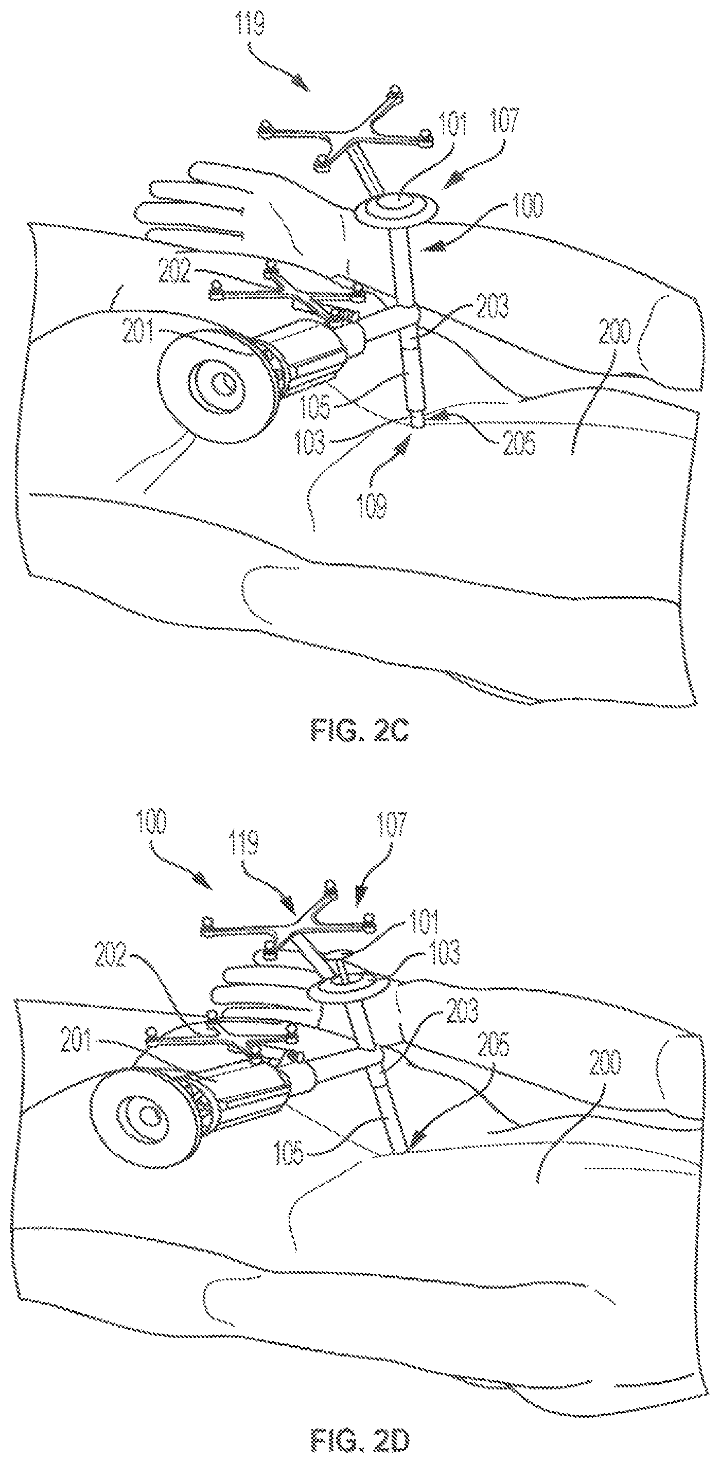 Patent US12102394 Figure 4 – Multi-stage dilator and cannula system and method