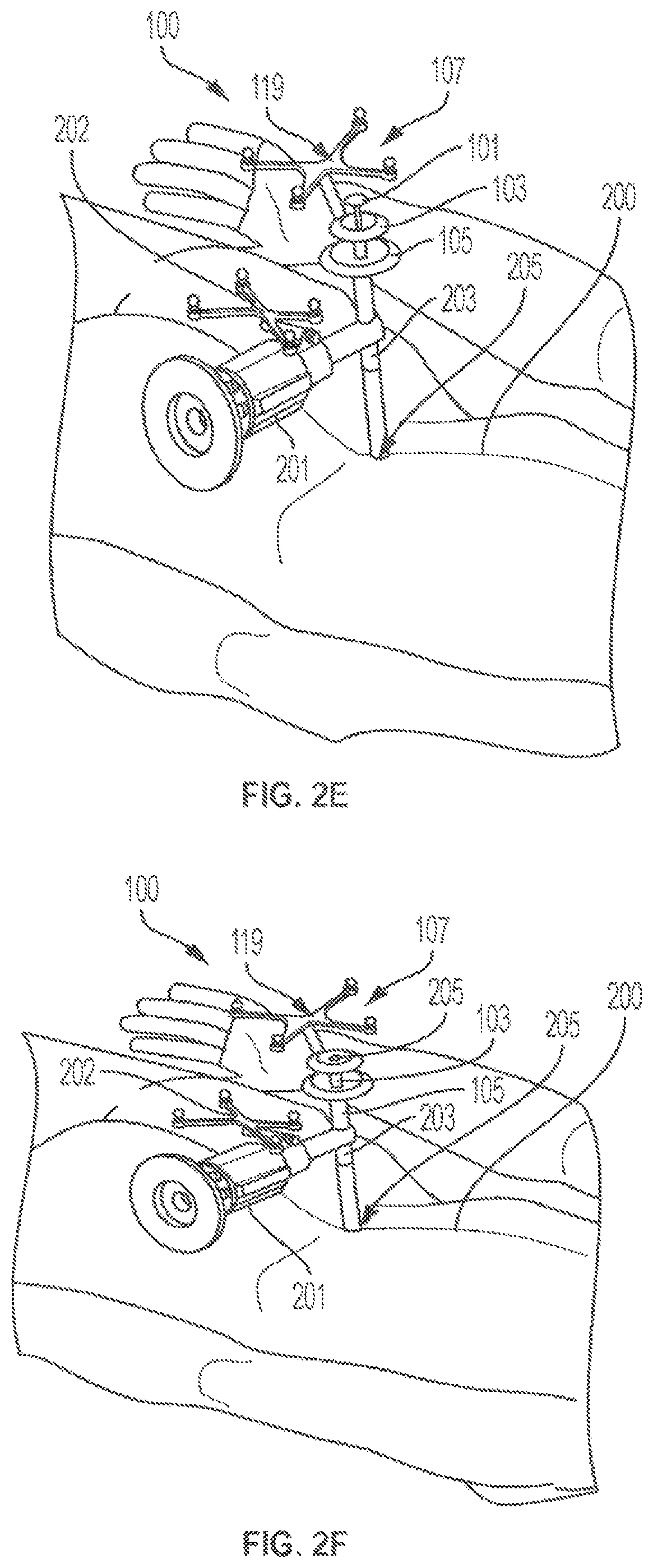 Patent US12102394 Figure 5 – Multi-stage dilator and cannula system and method
